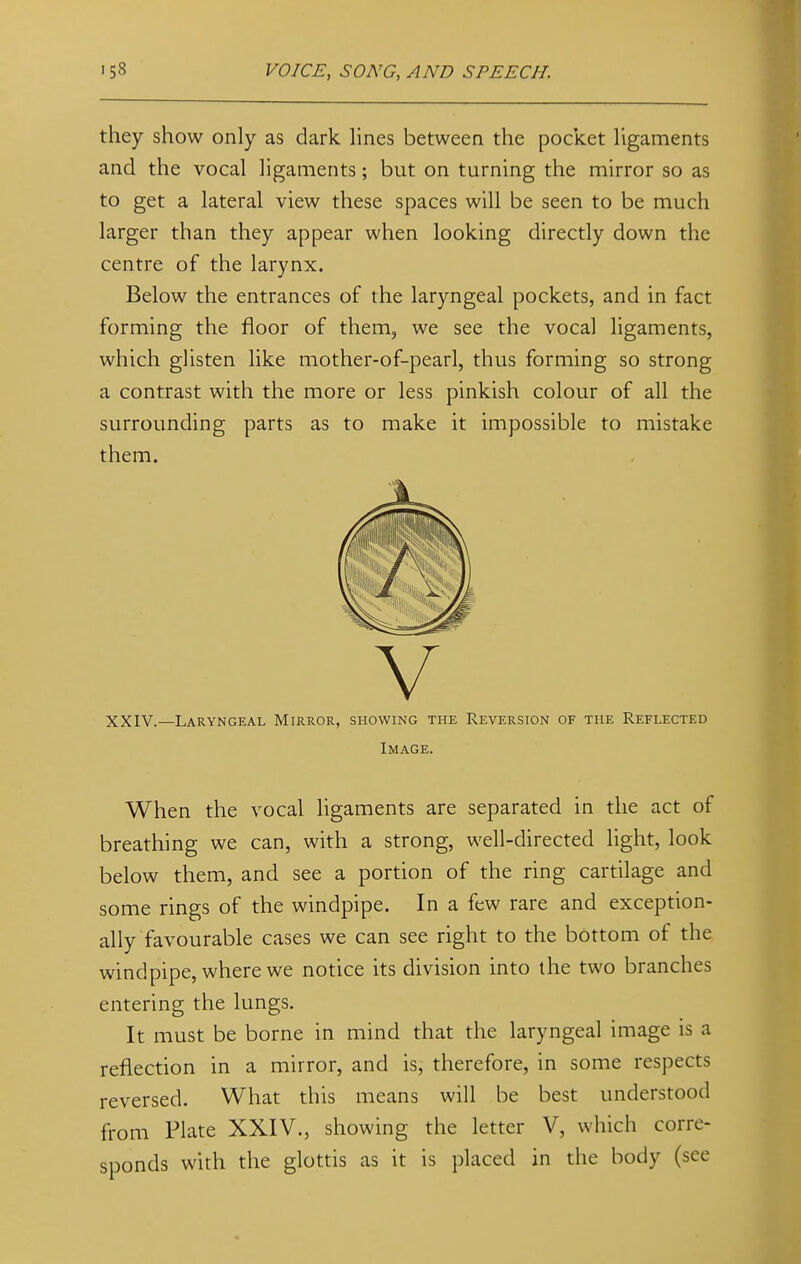 they show only as dark lines between the pocket ligaments and the vocal ligaments; but on turning the mirror so as to get a lateral view these spaces will be seen to be much larger than they appear when looking directly down the centre of the larynx. Below the entrances of the laryngeal pockets, and in fact forming the floor of them, we see the vocal ligaments, which glisten like mother-of-pearl, thus forming so strong a contrast with the more or less pinkish colour of all the surrounding parts as to make it impossible to mistake them. V XXIV.—Laryngeal Mirror, showing the Reversion of the Reflected Image. When the vocal ligaments are separated in the act of breathing we can, with a strong, well-directed light, look below them, and see a portion of the ring cartilage and some rings of the windpipe. In a few rare and exception- ally favourable cases we can see right to the bottom of the windpipe, where we notice its division into the two branches entering the lungs. It must be borne in mind that the laryngeal image is a reflection in a mirror, and is, therefore, in some respects reversed. What this means will be best understood from Plate XXIV., showing the letter V, which corre- sponds with the glottis as it is placed in the body (see