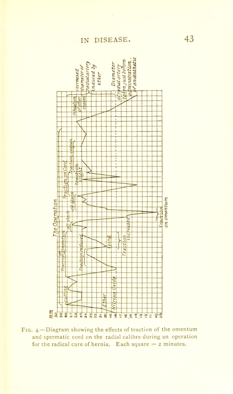 Fig. 4.—Diagram showing the effects of traction of the omentum and spermatic cord on the radial calibre during an operation for the radical cure of hernia. Each square = 2 minutes.