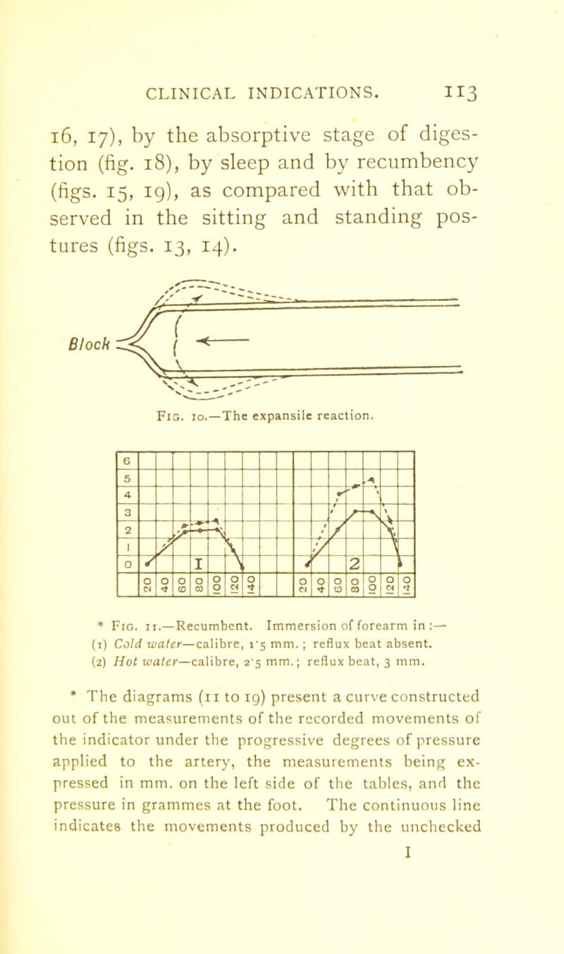 16, 17), by the absorptive stage of diges- tion (fig. 18), by sleep and by recumbency (figs. 15, ig), as compared with that ob- served in the sitting and standing pos- tures (figs. 13, 14). Fig. 10.—The expansile reaction. 6 5 4 3 f4-* — r 2 '-\ V - 2 0 c DOC f to 0 1 0 c i 0 t 3 0 3 3 c < 0 0 C 1 ^ ( 3 0 C 0 03 1 5 3 0 0 3 Cj -t * Fig. II.—Recumbent. Immersion of forearm in (1) Cold te/(i(£r—calibre, I's mm.; reflux beat absent. (2) Hot laaler—calibre, 2'5 mm.; reflux beat, 3 mm. * The diagrams (11 to 19) present a curve constructed out of the measurements of the recorded movements of the indicator under the progressive degrees of pressure applied to the artery, the measurements being ex- pressed in mm. on the left side of the tables, and the pressure in grammes at the foot. The continuous line indicates the movements produced by the unchecked I