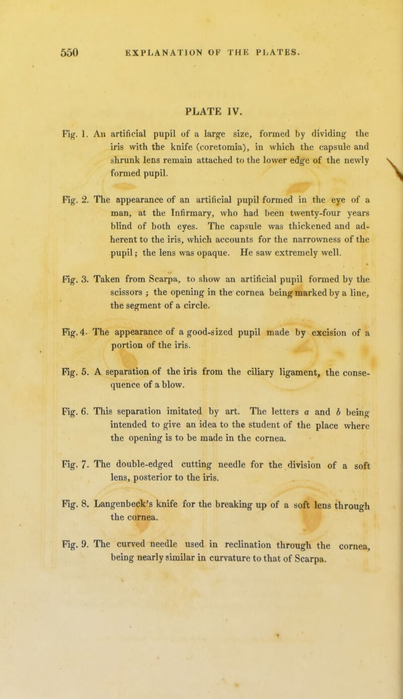 PLATE IV. Fig. 1. An artificial pupil of a large size, formed by dividing- the iris with the knife (coretomia), in which the capsule and shrunk lens remain attached to the lower edge of the newly formed pupil. Fig. 2. The appearance of an artificial pupil formed in the eye of a man, at the Infirmary, who had been twenty-four years blind of both eyes. The capsule was thickened and ad- herent to the iris, which accounts for the narrowness of the pupil; the lens was opaque. He saw extremely well. Fig. 3. Taken from Scarpa, to show an artificial pupil formed by the scissors ; the opening in the cornea being marked by a line, the segment of a circle. Fig. 4- The appearance of a good-sized pupil made by excision of a portion of the iris. Fig. 5. A separation of the iris from the ciliary ligament, the conse- quence of a blow. Fig. 6. This separation imitated by art. The letters a and b being- intended to give an idea to the student of the place where the opening is to be made in the cornea. Fig. 7. The double-edged cutting needle for the division of a soft lens, posterior to the iris. Fig. 8. Langenbeck's knife for the breaking up of a soft lens through the cornea. Fig. 9. The curved needle used in reclination through the cornea, being nearly similar in curvature to that of Scarpa.