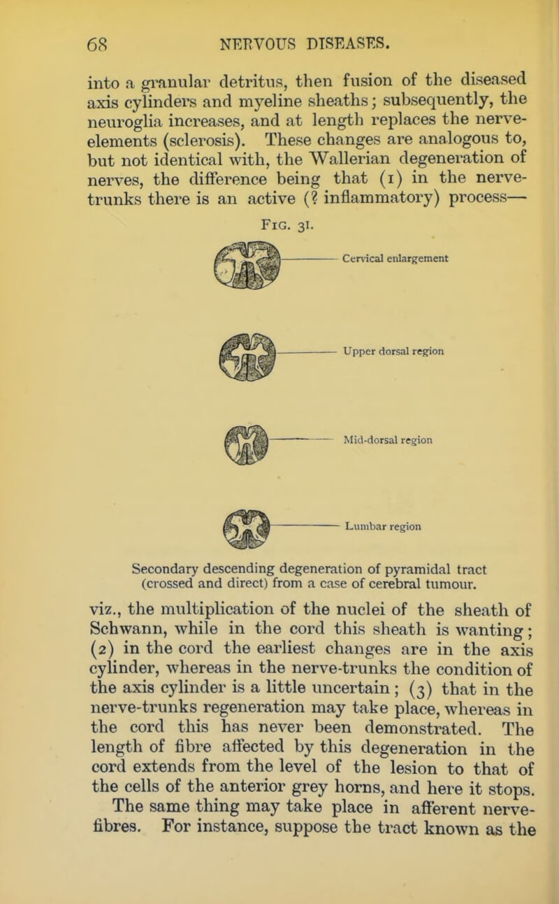 into a granular detritus, then fusion of the diseased axis cylinders and myeline sheaths; subsequently, the neuroglia increases, and at length replaces the nerve- elements (sclerosis). These changes are analogous to, but not identical with, the Wallerian degeneration of nerves, the difference being that (i) in the nerve- trunks there is an active (? inflammatory) process— Fig. 31. - Cervical enlargement Upper dorsal region Mid-dorsal region - Lumbar region Secondary descending degeneration of pyramidal tract (crossed and direct) from a case of cerebral tumour. viz., the multiplication of the nuclei of the sheath of Schwann, while in the cord this sheath is wanting; (2) in the cord the earliest changes are in the axis cylinder, whereas in the nerve-trunks the condition of the axis cylinder is a little uncertain ; (3) that in the nerve-trunks regeneration may take place, whereas in the cord this has never been demonstrated. The length of fibre affected by this degeneration in the cord extends from the level of the lesion to that of the cells of the anterior grey horns, and here it stops. The same thing may take place in afferent nerve- fibres. For instance, suppose the tract known as the