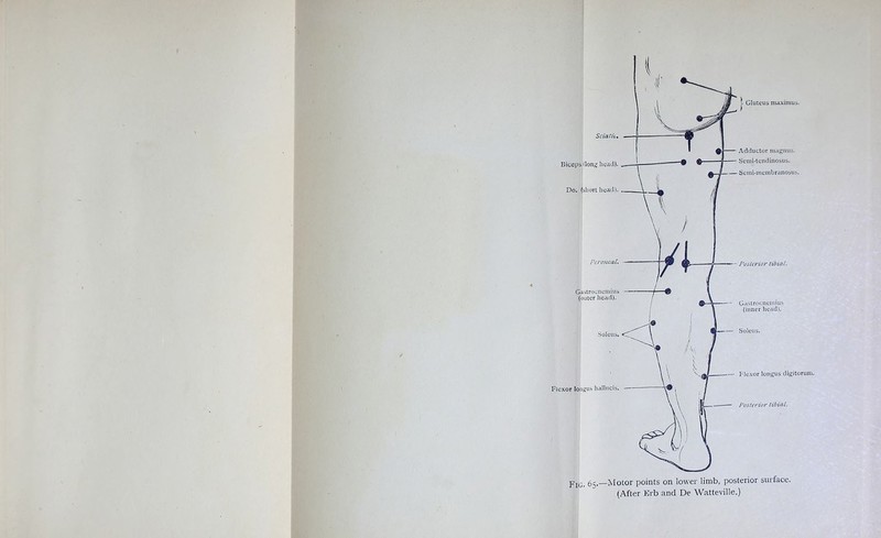 Sciatic, Biceps .(long head). _ Do. (short head) Peroneal. Gastrocnemius (outer head). Soleus. Flexor Iongus hallucis. :• Gluteus maximus. Adductor magnus. Semi-tcndinosus. Seim-menibranosus. Posterior tibial. Gastrocnemius (inner head). Soleus. Flexor longus digitorum. Posterior tibial. FlG 65.—Motor points on lower limb, posterior surface.