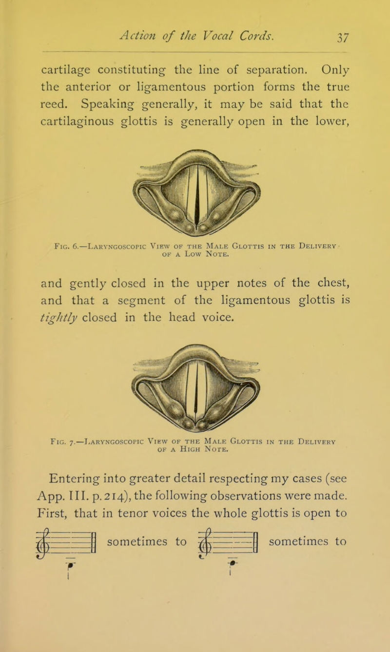 cartilage constituting the line of separation. Only the anterior or ligamentous portion forms the true reed. Speaking generally, it may be said that the cartilaginous glottis is generally open in the lower, Fig. 6.—Laryngoscopy View of the Male Glottis in the Delivery' of a Low Note. and gently closed in the upper notes of the chest, and that a segment of the ligamentous glottis is tigJitly closed in the head voice. Fig. 7.—Laryngoscopy View of the Male Glottis in the Delivery of a High Note. Entering into greater detail respecting my cases (see App. III. p. 214), the following observations were made. First, that in tenor voices the whole glottis is open to EE sometimes to sometimes to