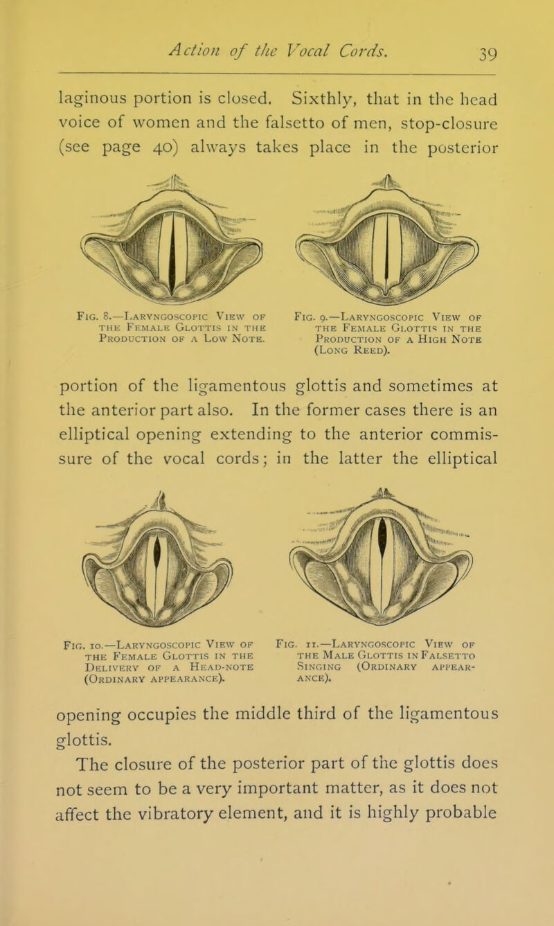 laginous portion is closed. Sixthly, that in the head voice of women and the falsetto of men, stop-closure (see page 40) always takes place in the posterior •A Fig. 8.—Laryngoscopy View of the Female Glottis in the Production of a Low Note. Fig. 9.—Laryngoscopy View of the Female Glottis in the Production of a High Note (Long Reed). portion of the ligamentous glottis and sometimes at the anterior part also. In the former cases there is an elliptical opening extending to the anterior commis- sure of the vocal cords; in the latter the elliptical Fig. 10.—Laryngoscopy View of the Female Glottis in the Delivery of a Head-note (Ordinary appearance). Fig. 11.—Laryngoscopy View of the Male Glottis in Falsetto Singing (Ordinary appear- ance). opening occupies the middle third of the ligamentous glottis. The closure of the posterior part of the glottis does not seem to be a very important matter, as it does not affect the vibratory element, and it is highly probable