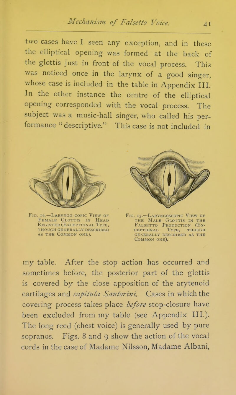 two cases have I seen any exception, and in these the elliptical opening was formed at the back of the glottis just in front of the vocal process. This was noticed once in the larynx of a good singer, whose case is included in the table in Appendix III. In the other instance the centre of the elliptical opening corresponded with the vocal process. The subject was a music-hall singer, who called his per- formance descriptive. This case is not included in Fig. n.—Laryngo copic View of Female Glottis in Head Register (Exceptional Type, though generally described as the Common one). Fig. 13.—Laryngoscopy View of the Male Glottis in the Falsetto Production (Ex- ceptional Type, though generally described as the Common one). my table. After the stop action has occurred and sometimes before, the posterior part of the glottis is covered by the close apposition of the arytenoid cartilages and capitula Santorini. Cases in which the covering process takes place before stop-closure have been excluded from my table (see Appendix III.). The long reed (chest voice) is generally used by pure sopranos. Figs. 8 and 9 show the action of the vocal cords in the case of Madame Nilsson, Madame Albani,