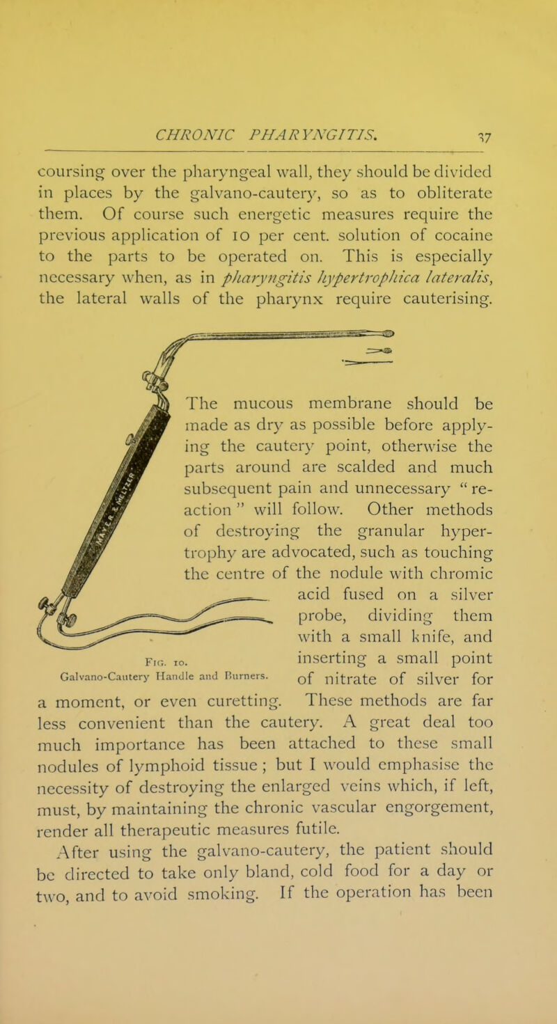 coursing over the pharyngeal wall, they should be divided in places by the galvano-cautcry, so as to obliterate them. Of course such energetic measures require the previous application of io per cent, solution of cocaine to the parts to be operated on. This is especially necessary when, as in pharyngitis Jiypertrophica lateralis, the lateral walls of the pharynx require cauterising. Galvano-Cautery Handle and Burners. nitrate of silvd* for a moment, or even curetting. These methods are far less convenient than the cautery. A great deal too much importance has been attached to these small nodules of lymphoid tissue ; but I would emphasise the necessity of destroying the enlarged veins which, if left, must, by maintaining the chronic vascular engorgement, render all therapeutic measures futile. After using the galvano-cautery, the patient should be directed to take only bland, cold food for a clay or two, and to avoid smoking. If the operation has been The mucous membrane should be made as dry as possible before apply- ing the cautery point, otherwise the parts around are scalded and much subsequent pain and unnecessary  re- action  will follow. Other methods of destroying the granular hyper- trophy are advocated, such as touching the centre of the nodule with chromic acid fused on a silver probe, dividing them with a small knife, and inserting a small point