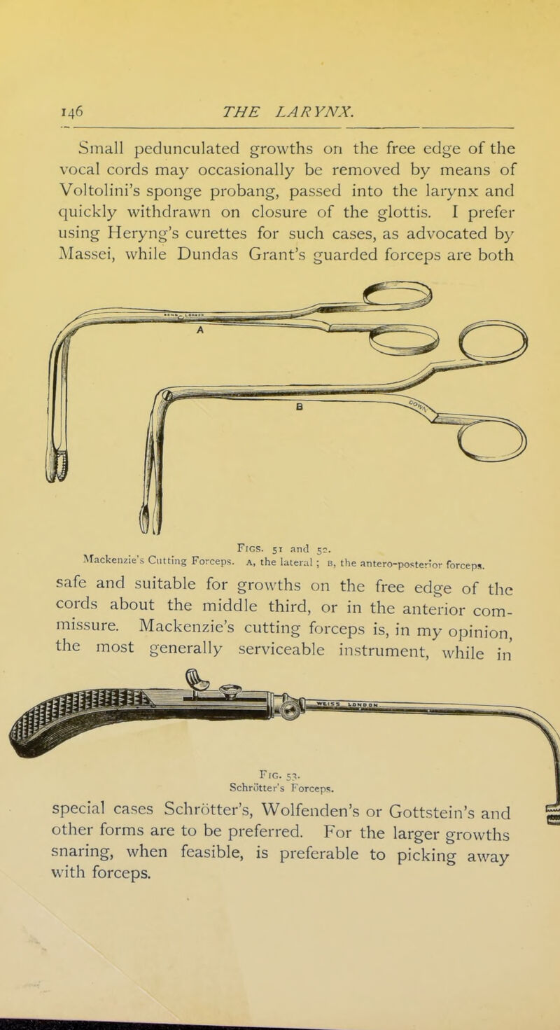 Small pedunculated growths on the free edge of the vocal cords may occasionally be removed by means of Voltolini's sponge probang, passed into the larynx and quickly withdrawn on closure of the glottis. I prefer using Heryng's curettes for such cases, as advocated by Massei, while Dundas Grant's guarded forceps are both Fins. 51 and 5:. Mackenzie's Cutting Forceps, a, the lateral ; b, the antero-postenor forceps. safe and suitable for growths on the free edge of the cords about the middle third, or in the anterior com- missure. Mackenzie's cutting forceps is, in my opinion, the most generally serviceable instrument, while in Fig. s?. Schriitter's Forceps. special cases Schrotter's, Wolfenden's or Gottstein's and other forms are to be preferred. For the larger growths snaring, when feasible, is preferable to picking away with forceps.