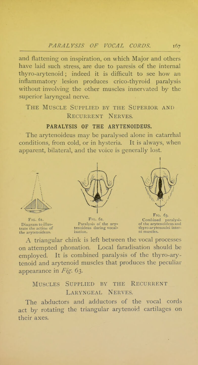 and flattening on inspiration, on which Major and others have laid such stress, are due to paresis of the internal thyro-arytenoid ; indeed it is difficult to see how an inflammatory lesion produces crico-thyroid paralysis without involving the other muscles innervated by the superior laryngeal nerve. The Muscle Supplied by the Superior and Recurrent Nerves. PARALYSIS OF THE ARYTENOIDEUS. The arytcnoideus may be paralysed alone in catarrhal conditions, from cold, or in hysteria. It is always, when apparent, bilateral, and the voice is generally lost. Fig. 61. Diasram to illus- trate the action of the arytenoidfcus. Fir.. 62. Paralysis of the ary- tenoideus during vocal- isation. Fig. 63. Combined paralysis of the arytenoideus and thyro-arytenoidei inter- ni muscles. A triangular chink is left between the vocal processes on attempted phonation. Local faradisation should be employed. It is combined paralysis of the thyro-ary- tenoid and arytenoid muscles that produces the peculiar appearance in Fig. 63. Muscles Supplied by the Recurrent Laryngeal Nerves. The abductors and adductors of the vocal cords act by rotating the triangular arytenoid cartilages on their axes.