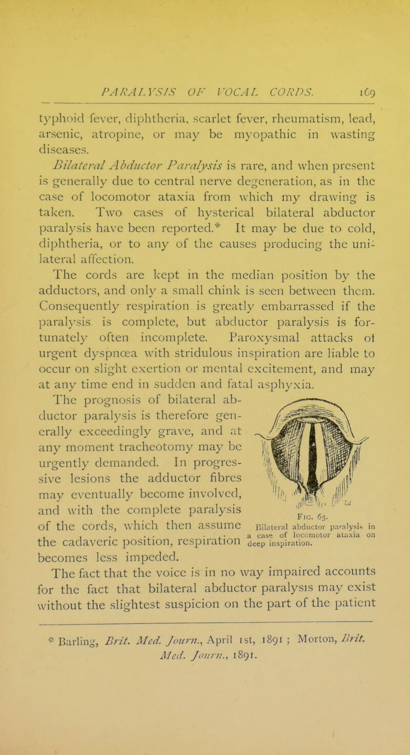 typhoid fever, diphtheria, scarlet fever, rheumatism, lead, arsenic, atropine, or may be myopathic in wasting diseases. Bilateral Abductor Paralysis is rare, and when present is generally due to central nerve degeneration, as in the case of locomotor ataxia from which my drawing is taken. Two cases of hysterical bilateral abductor paralysis have been reported.* It may be due to cold, diphtheria, or to any of the causes producing the uni- lateral affection. The cords are kept in the median position by the adductors, and only a small chink is seen between them. Consequently respiration is greatly embarrassed if the paralysis is complete, but abductor paralysis is for- tunately often incomplete. Paroxysmal attacks ot urgent dyspnoea with stridulous inspiration are liable to occur on slight exertion or mental excitement, and may at any time end in sudden and fatal asphyxia. The prognosis of bilateral ab- ductor paralysis is therefore gen- erally exceedingly grave, and at any moment tracheotomy may be urgently demanded. In progres- sive lesions the adductor fibres may eventually become involved, and with the complete paralysis f, ,'' 1 1 J Fig. 65. Of the COrds, which then assume Bilateral abductor paralysis in , . . . . . .. a case of locomotor ataxia on the cadaveric position, respiration deep inspiration, becomes less impeded. The fact that the voice is in no way impaired accounts for the fact that bilateral abductor paralysis may exist without the slightest suspicion on the part of the patient 8 Barling, Brit. Med. Journ., April 1st, 1S91 ; Morton, Brit. Med. J011)11., 1891.