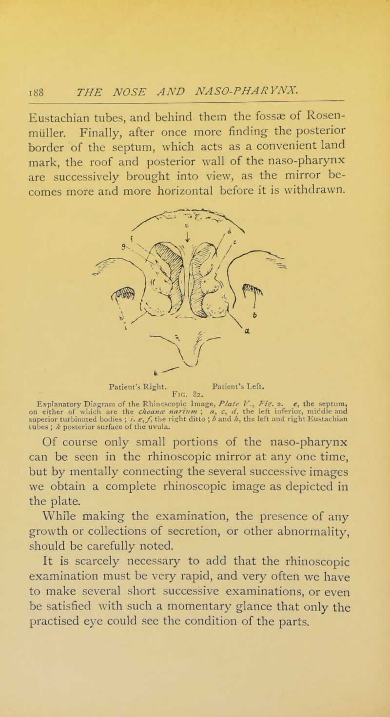 Eustachian tubes, and behind them the fossae of Rosen- muller. Finally, after once more finding the posterior border of the septum, which acts as a convenient land mark, the roof and posterior wall of the naso-pharynx are successively brought into view, as the mirror be- comes more and more horizontal before it is withdrawn. Patient's Right. Patient's Left. Fir;. S2. Explanatory Di.ngr.im of the Rhincscopic Image, Plate /., Fisr. 2. e, the septum, on either of which are the choanic nariiim ; a, c, d. the left inferior, middle and superior turbinated bodies ; /. e,f, the right ditto ; b and h, the left and right Eustachian lubes ; k posterior surface of the uvula. Of course only small portions of the naso-pharynx can be seen in the rhinoscopic mirror at any one time, but by mentally connecting the several successive images we obtain a complete rhinoscopic image as depicted in the plate. While making the examination, the presence of any growth or collections of secretion, or other abnormality, should be carefully noted. It is scarcely necessary to add that the rhinoscopic examination must be very rapid, and very often we have to make several short successive examinations, or even be satisfied with such a momentary glance that only the practised eye could see the condition of the parts.