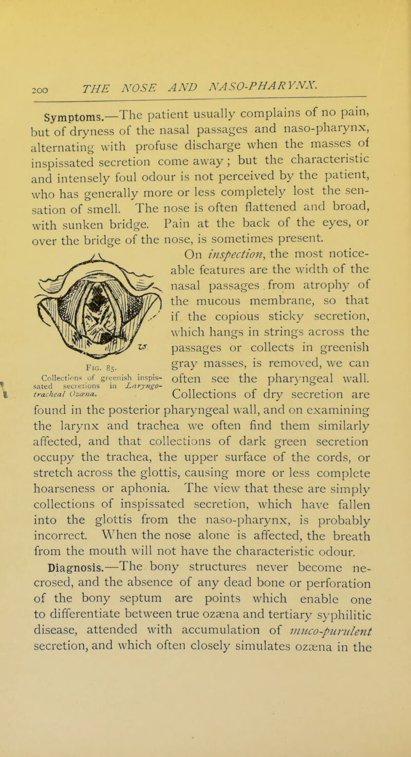 Symptoms.—The patient usually complains of no pain, but of dryness of the nasal passages and naso-pharynx, alternating with profuse discharge when the masses of inspissated secretion come away ; but the characteristic and intensely foul odour is not perceived by the patient, who has generally more or less completely lost the sen- sation of smell. The nose is often flattened and broad, with sunken bridge. Pain at the back of the eyes, or over the bridge of the nose, is sometimes present. On inspection, the most notice- able features are the width of the nasal passages . from atrophy of the mucous membrane, so that if the copious sticky secretion, which hangs in strings across the passages or collects in greenish gray masses, is removed, we can Collections of greenish inspis- often see the pharyngeal wall.  sated secretions in Laryngo- 1 % tracheal Oztgna. Collections of dry secretion are found in the posterior pharyngeal wall, and on examining the larynx and trachea we often find them similarly affected, and that collections of dark green secretion occupy the trachea, the upper surface of the cords, or stretch across the glottis, causing more or less complete hoarseness or aphonia. The view that these are simply collections of inspissated secretion, which have fallen into the glottis from the naso-pharynx, is probably incorrect. When the nose alone is affected, the breath from the mouth will not have the characteristic odour. Diagnosis.—The bony structures never become ne- crosed, and the absence of any dead bone or perforation of the bony septum are points which enable one to differentiate between true ozaena and tertiary syphilitic disease, attended with accumulation of muco-pitntlent secretion, and which often closely simulates ozama in the