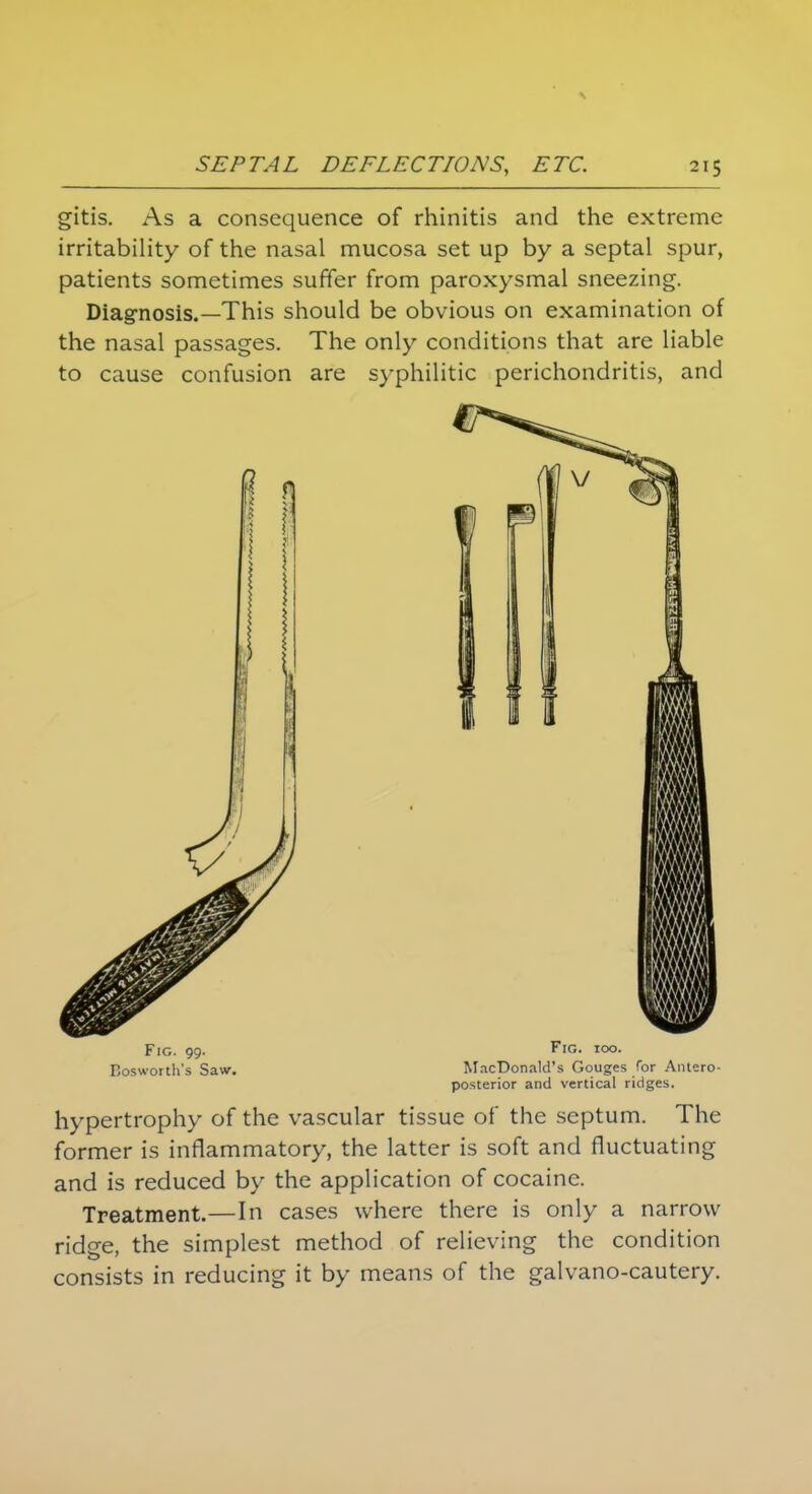gitis. As a consequence of rhinitis and the extreme irritability of the nasal mucosa set up by a septal spur, patients sometimes suffer from paroxysmal sneezing. Diagnosis.—This should be obvious on examination of the nasal passages. The only conditions that are liable to cause confusion are syphilitic perichondritis, and Fig. 99. Fie 100. Kosworth's Saw. MacDonald's Gouges for Antero- posterior and vertical ridges. hypertrophy of the vascular tissue of the septum. The former is inflammatory, the latter is soft and fluctuating and is reduced by the application of cocaine. Treatment.—In cases where there is only a narrow ridge, the simplest method of relieving the condition consists in reducing it by means of the galvano-cautery.