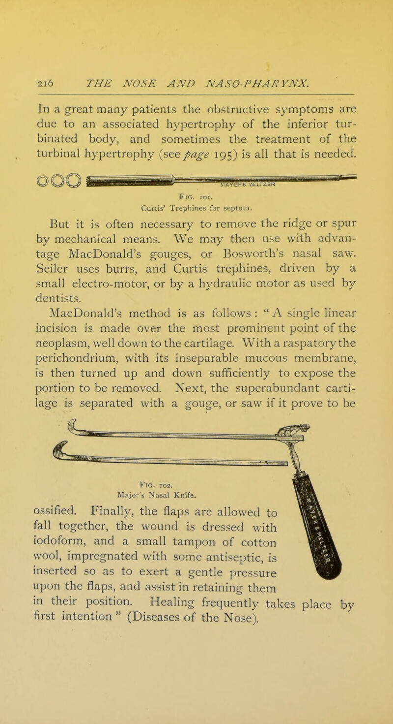 In a great many patients the obstructive symptoms are due to an associated hypertrophy of the inferior tur- binated body, and sometimes the treatment of the turbinal hypertrophy (see page 195) is all that is needed. MAYER* Fig. ioi. Curtis' Trephines for septum. But it is often necessary to remove the ridge or spur by mechanical means. We may then use with advan- tage MacDonald's gouges, or Bosworth's nasal saw. Seiler uses burrs, and Curtis trephines, driven by a small electro-motor, or by a hydraulic motor as used by dentists. MacDonald's method is as follows :  A single linear incision is made over the most prominent point of the neoplasm, well down to the cartilage. With a raspatory the perichondrium, with its inseparable mucous membrane, is then turned up and down sufficiently to expose the portion to be removed. Next, the superabundant carti- lage is separated with a gouge, or saw if it prove to be Fig. 102. Major's Nasal Knife. ossified. Finally, the flaps are allowed to fall together, the wound is dressed with iodoform, and a small tampon of cotton wool, impregnated with some antiseptic, is inserted so as to exert a gentle pressure upon the flaps, and assist in retaining them in their position. Healing frequently takes place by first intention  (Diseases of the Nose).