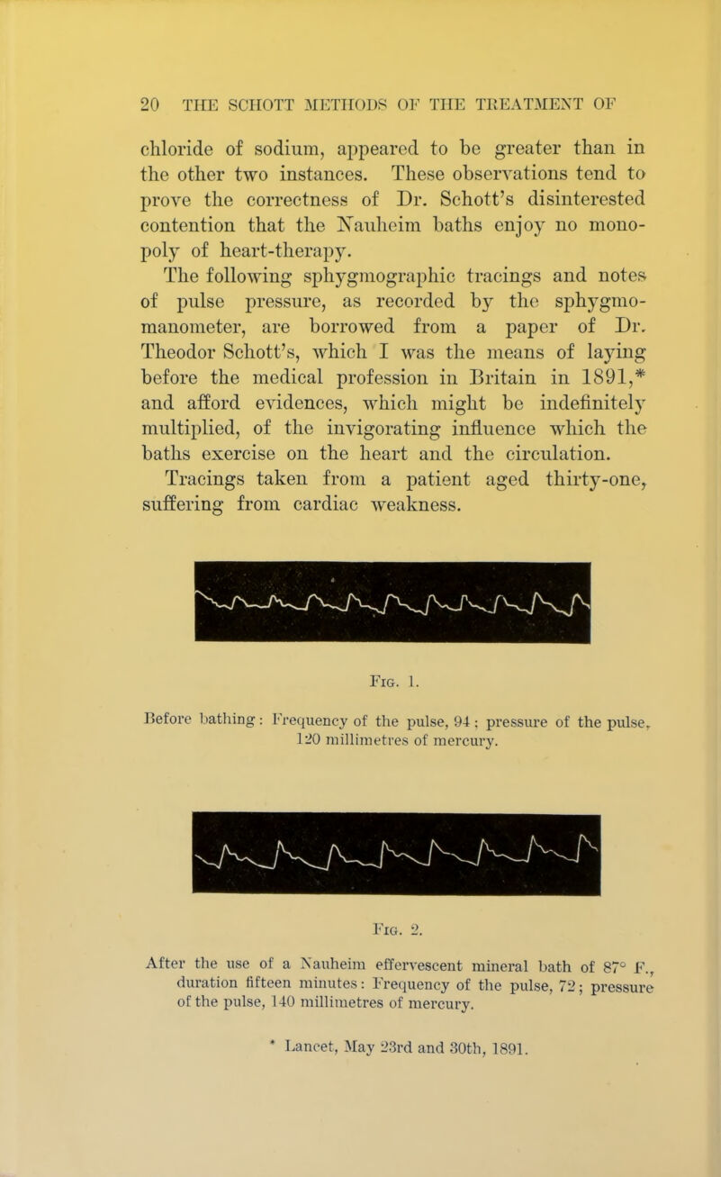chloride of sodium, appeared to be greater than in the other two instances. These observations tend to prove the correctness of Dr. Schott's disinterested contention that the Nauheim baths enjoy no mono- poly of heart-therapy. The following sphygmographic tracings and notes of pulse pressure, as recorded by the sphygmo- manometer, are borrowed from a paper of Dr. Theodor Schott's, which I was the means of laying before the medical profession in Britain in 1891,* and afford evidences, which might be indefinitely multiplied, of the invigorating influence which the baths exercise on the heart and the circulation. Tracings taken from a patient aged thirty-one, suffering from cardiac weakness. Fig. 1. Before bathing: Frequency of the pulse, 94 ; pressure of the pulset 120 millimetres of mercury. Fig. 2. After the use of a jN'auheim effervescent mineral bath of 87° F., duration fifteen minutes: Frequency of the pulse, 72; pressure of the pulse, 140 millimetres of mei'cury. * Lancet, May 23rd and 30th, 1891.