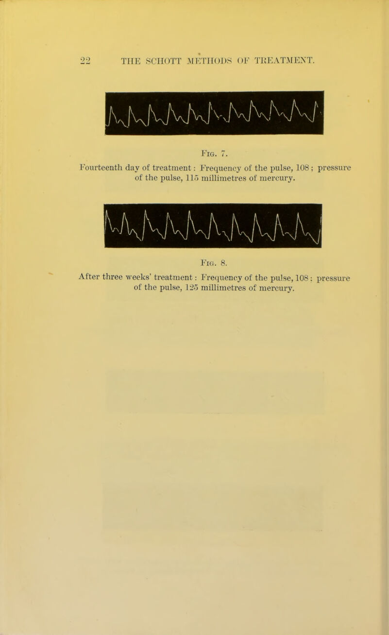 Fig. 7. Fourteenth day of treatment: Frequency of the pulse, 108; pressure of the pulse, 115 millimetres of mercury. Fig. 8. After three weeks' treatment: Frequency of the pulse, 108: pressure of the pulse, 125 millimetres of mercury.
