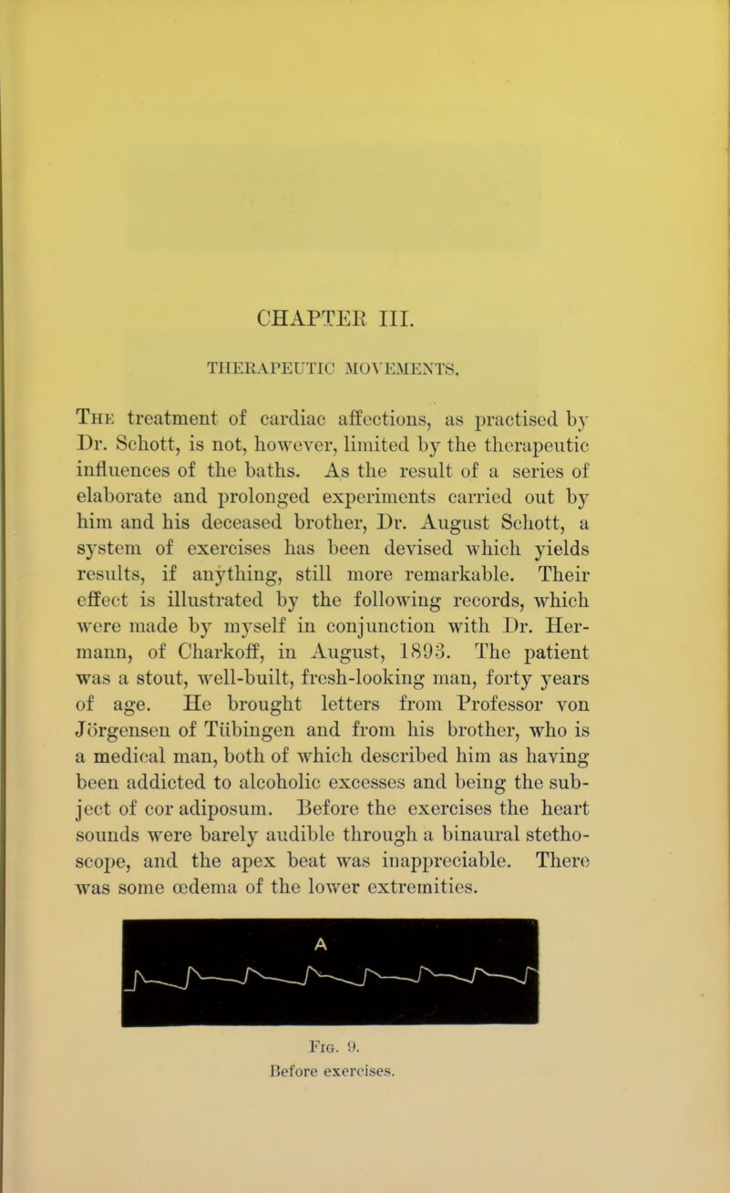 CHAPTER III. THERAPEUTIC MOVEM ENTS, The treatment of cardiac affections, as practised by Dr. Schott, is not, however, limited by the therapeutic influences of the baths. As the result of a series of elaborate and prolonged experiments carried out by him and his deceased brother, Dr. August Schott, a system of exercises has been devised which yields results, if anything, still more remarkable. Their effect is illustrated by the following records, which were made by myself in conjunction with Dr. Her- mann, of Charkoff, in August, 1893. The patient was a stout, well-built, fresh-looking man, forty years of age. He brought letters from Professor von Jorgensen of Tubingen and from his brother, who is a medical man, both of which described him as having been addicted to alcoholic excesses and being the sub- ject of cor adiposum. Before the exercises the heart sounds were barely audible through a binaural stetho- scope, and the apex beat was inappreciable. There was some cedema of the lower extremities. Fig. 9. Before exercises.