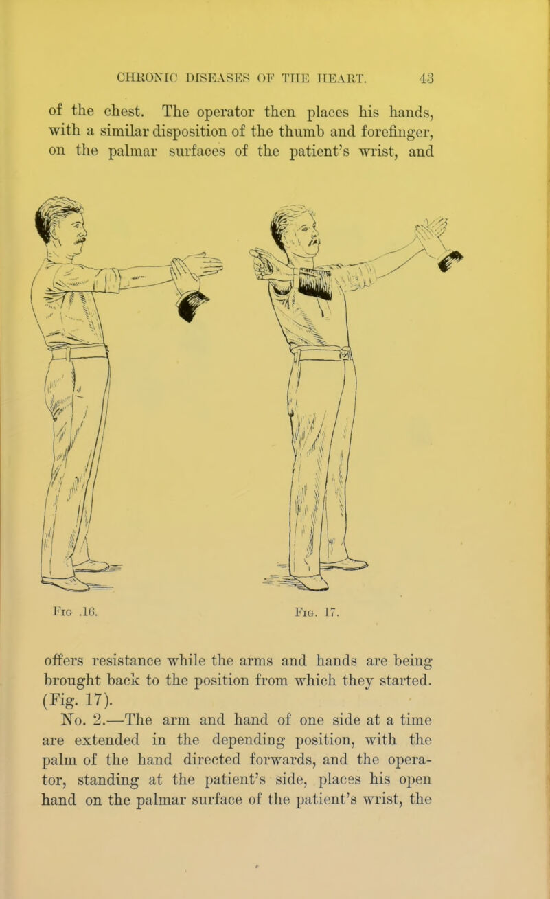 of the chest. The operator then places his hands, with a similar disposition of the thumb and forefinger, on the palmar surfaces of the patient's wrist, and Fig .16. Fig. 17. offers resistance while the arms and hands are being brought back to the position from which they started. (Kg. 17). ~No. 2.—The arm and hand of one side at a time are extended in the depending position, with <jhe palm of the hand directed forwards, and the opera- tor, standing at the patient's side, places his open hand on the palmar surface of the patient's wrist, the