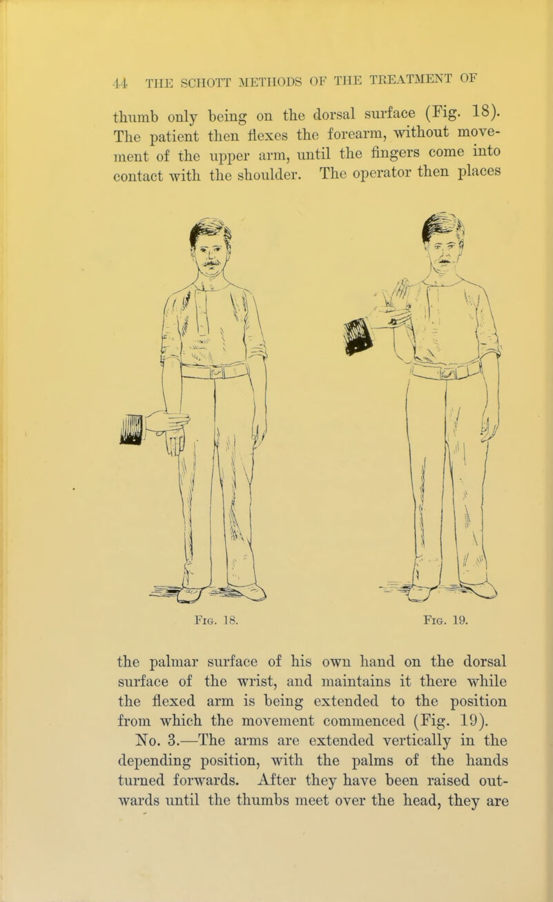 thumb only being on the dorsal surface (Fig. 18). The patient then flexes the forearm, without move- ment of the upper arm, until the fingers come into contact with the shoulder. The operator then places Fig, 18. Fig. 19. the palmar surface of his own hand on the dorsal surface of the wrist, and maintains it there while the flexed arm is being extended to the position from which the movement commenced (Fig. 19). No. 3.—The arms are extended vertically in the depending position, with the palms of the hands turned forwards. After they have been raised out- wards until the thumbs meet over the head, they are