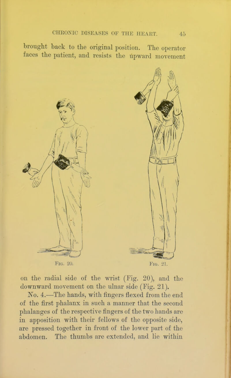 brought back to the original position. The operator faces the patient, and resists the upward movement Fig. 20. Fig. 21. on the radial side of the wrist (Fig. 20), and the downward movement on the ulnar side (Fig. 21). No. 4.—The hands, with fingers flexed from the end of the first phalanx in such a manner that the second phalanges of the respective fingers of the two hands are in apposition with their fellows of the opposite side, are pressed together in front of the lower part of the abdomen. The thumbs are extended, and lie within