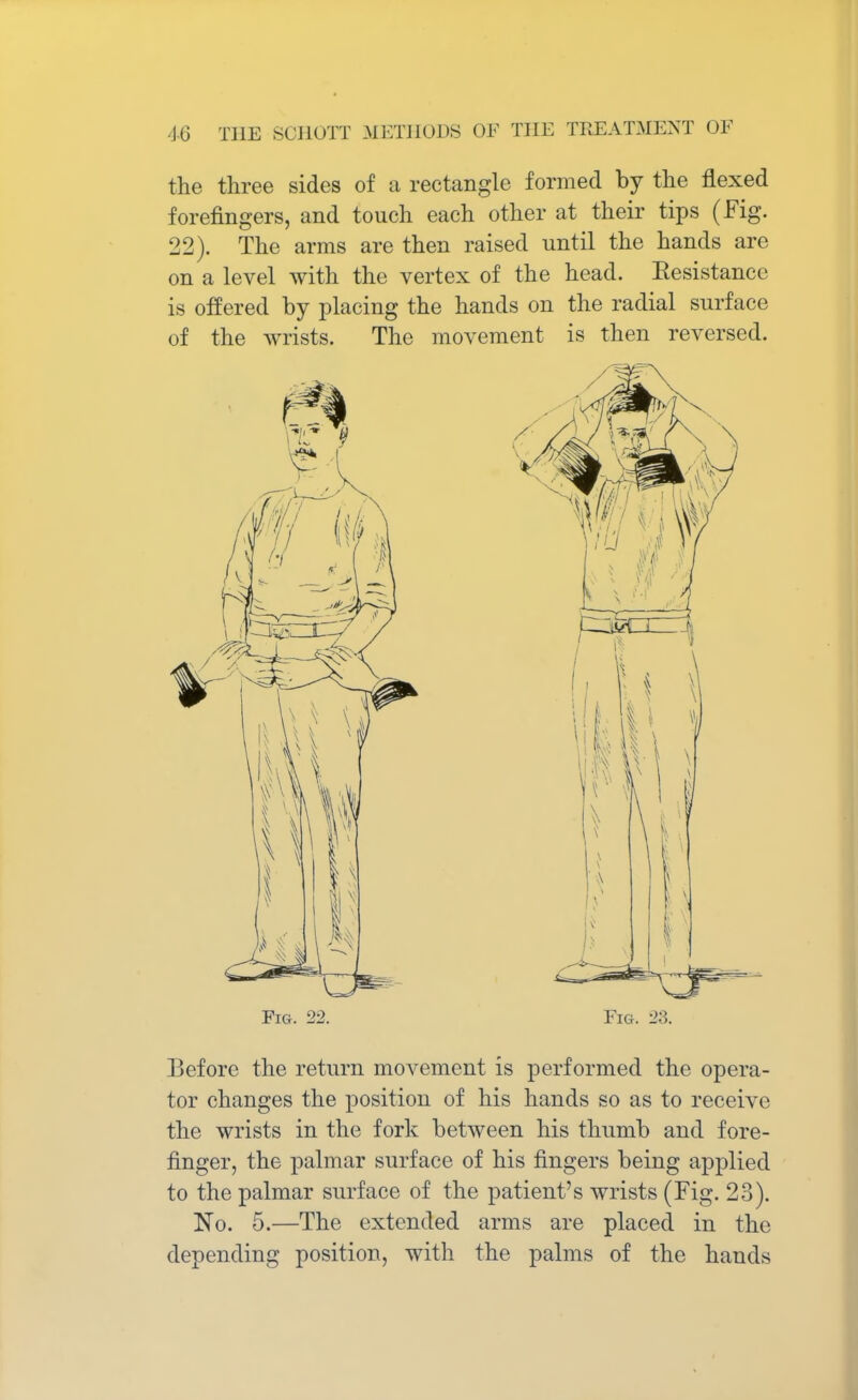 the three sides of a rectangle formed by the flexed forefingers, and touch each other at their tips (Fig. 22). The arms are then raised until the hands are on a level with the vertex of the head. Eesistancc is offered by placing the hands on the radial surface of the wrists. The movement is then reversed. Fig. 22. Fig. 28. Before the return movement is performed the opera- tor changes the position of his hands so as to receive the wrists in the fork between his thumb and fore- finger, the palmar surface of his fingers being applied to the palmar surface of the patient's wrists (Fig. 23). No. 5.—The extended arms are placed in the depending position, with the palms of the hands