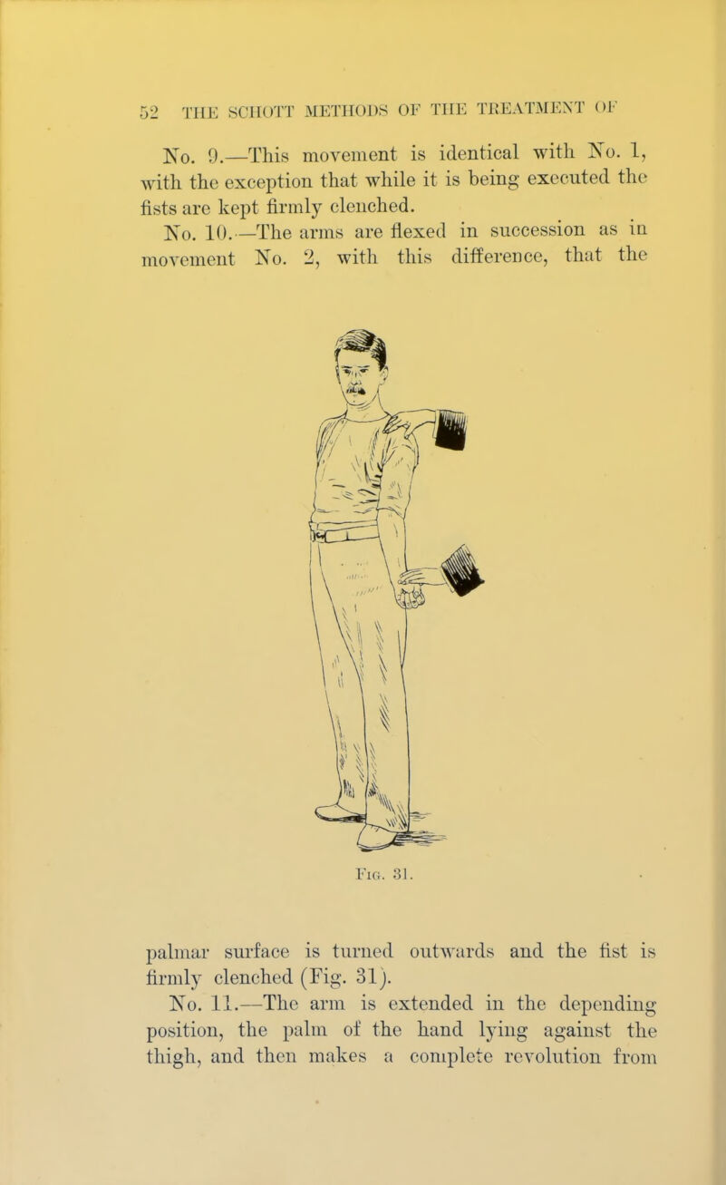 Xo. 9.—This movement is identical with No. 1, with the exception that while it is being executed the fists are kept firmly clenched. X0- 10. —The arms are flexed in succession as in movement No. 2, with this difference, that the Fig. 31. palmar surface is turned outwards and the fist is firmly clenched (Fig. 31). No. 11.—The arm is extended in the depending position, the palm of the hand lying against the thigh, and then makes a complete revolution from