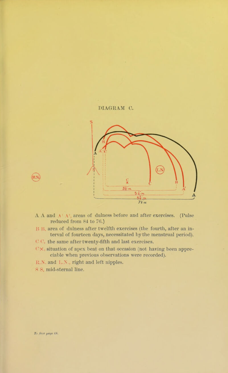 A A and \ \ . areas of dulness before and after exercises. (Pulse reduced from 84 to 76.) B 15. area of dulness after twelfth exercises (the fourth, after an in- terval of fourteen days, necessitated by the menstrual period). C C, the same after twenty-fifth and last exercises. I'X. situation of apex beat on that occasion (not having been appre- ciable when previous observations were recorded). R.N. and I..N.. right and left nipples. PI S, mid-sternal line.