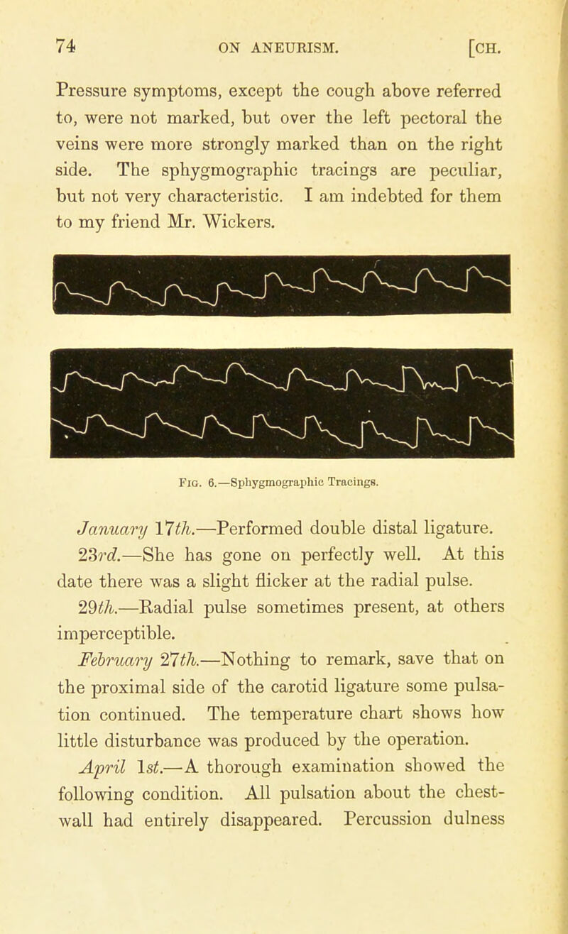 Pressure symptoms, except the cough above referred to, were not marked, but over the left pectoral the veins were more strongly marked than on the right side. The sphygmographic tracings are peculiar, but not very characteristic. I am indebted for them to my friend Mr. Wickers. Fig. 6.—Sphygmographic Tracings. January 17th.—Performed double distal ligature. 23rd.—She has gone on perfectly well. At this date there was a slight flicker at the radial pulse. 29th.—Kadial pulse sometimes present, at others imperceptible. February 27th.—Nothing to remark, save that on the proximal side of the carotid ligature some pulsa- tion continued. The temperature chart shows how little disturbance was produced by the operation. April 1st.—-A thorough examination showed the following condition. All pulsation about the chest- wall had entirely disappeared. Percussion dulness