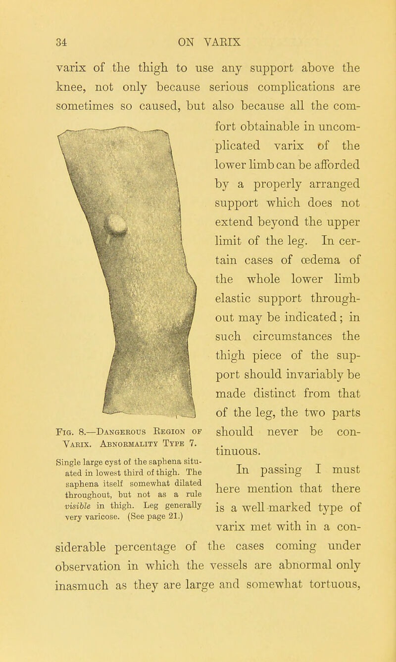 varix of the thigh to use any support above the knee, not only because serious complications are sometimes so caused, but also because all the com- fort obtainable in uncom- plicated varix of the lower limb can be afforded by a properly arranged support which does not extend beyond the upper limit of the leg. In cer- tain cases of oedema of the whole lower limb elastic support through- out may be indicated; in such circumstances the thigh piece of the sup- port should invariably be made distinct from that of the leg, the two parts should never be con- tinuous. In passing I must here mention that there Fig. 8.—Dangerous Eegion of Varix. Abnormality Type 7. Single large cyst of the saphena situ- ated in lowest third of thigh. The saphena itself somewhat dilated throughout, but not as a rule visible in thigh. Leg generally Jg a weV] .marked type of very varicose. (See page 21.) varix met with in a con- siderable percentage of the cases coming under observation in which the vessels are abnormal only inasmuch as they are large and somewhat tortuous,