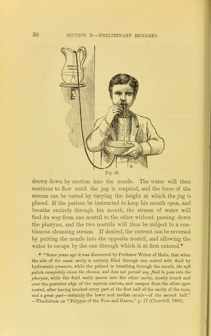 Fig. 4J. drawn clown by suction into the nozzle. The water will then continue to flow until the jug is emptied, and the force of the stream can be varied by varying the height at which the jug is placed. If the patient be instructed to keep his mouth open, and breathe entirely through his mouth, the stream of water will find its way from one nostril to the other without passing down the pharynx, and the two nostrils will thus be subject to a con- tinuous cleansing stream. If desired, the current can be reversed by putting the nozzle into the opposite nostril, and allowing the water to escape by the one through which it at first entered.* *  Some years ago it was discovered by Professor Weber of Halle, that when the side of the nasal cavity is entirely filled through one nostril with fluid by hydrostatic pressure, while the patient is breathing through the mouth, the soft palate completely closes tlie choanal, and does not permit any fluid to pass into the pharynx, while the fluid easily passes into the other cavity, mostly rouud and over the posterior edge of the septum narium, and escapes from the other open nostril, after having touched every part of the first half of the cavity of the nose, and a great part—certainly the lower and median canals—of the second half. —Thudichum on Polypus of the Nose and Ozsenn, p. 17 (Churchill, 1869).
