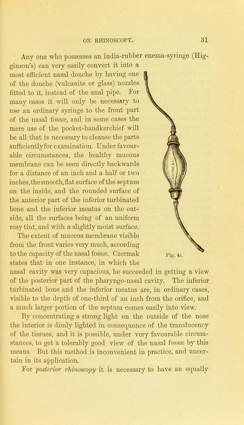 Any one who possesses an india-rubber enema-syringe (Hig- ginson's) can very easily convert it into a most efficient nasal douche by having one of the douche (vulcanite or glass) nozzles fitted to it, instead of the anal pipe. For many cases it will only be necessary to use an ordinary syringe to the front part of the nasal fossa?, and in some cases the mere use of the pocket-handkerchief will be all that is necessary to cleanse the parts sufficientlyfor examination. Under favour- able circumstances, the healthy mucous membrane can be seen directly backwards for a distance of an inch and a half or two inches, thesmooth,flat surface of the septum on the inside, and the rounded surface of the anterior part of the inferior turbinated bone and the inferior meatus on the out- side, all the surfaces being of an uniform rosy tint, and with a slightly moist surface. The extent of mucous membrane visible from the front varies very much, according to the capacity of the nasal fossa?. Czermak Fig. 4c. states that in one instance, in which the nasal cavity was very capacious, he succeeded in getting a view of the posterior part of the pharyngo-nasal cavity. The inferior turbinated bone and the inferior meatus are, in ordinary cases, visible to the depth of one-third of an inch from the orifice, and a much larger portion of the septum comes easily into view. By concentrating a strong light on the outside of the nose the interior is dimly lighted in consequence of the translucency of the tissues, and it is possible, under very favourable circum- stances, to get a tolerably good view of the nasal fossae by this means. But this method is inconvenient in practice, and uncer- tain in its application. For posterior rhinoscopy it is necessary to have an equally