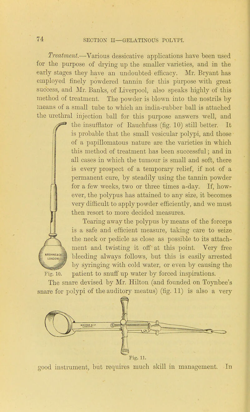 Treatment.—Various dessicative applications have been used for the purpose of drying up the smaller varieties, and in the early stages they have an undoubted efficacy. Mr. Bryant has employed finely powdered tannin for this purpose with great success, and Mr. Banks, of Liverpool, also speaks highly of this method of treatment. The powder is blown into the nostrils by means of a small tube to which an india-rubber ball is attached the urethral injection ball for this purpose answers well, and the insufflator of Bauchfuss (fig. 10) still better. It f is probable that the small vesicular polypi, and those of a papillomatous nature are the varieties in which this method of treatment has been successful; and in all cases in which the tumour is small and soft, there is every prospect of a temporary relief, if not of a permanent cure, by steadily using the tannin powder for a few weeks, two or three times a-day. If, how- ever, the polypus has attained to any size, it becomes very difficult to apply powder efficiently, and we must then resort to more decided measures. Tearing away the polypus by means of the forceps is a safe and efficient measure, taking care to seize the neck or pedicle as close as possible to its attach- ment and twisting it off at this point. Very free bleeding always follows, but this is easily arrested by syringing with cold water, or even by causing the patient to snuff up water by forced inspirations. The snare devised by Mr. Hilton (and founded on Toynbee's snare for polypi of the auditory meatus) (fig. 11) is also a very Fig. 10. Fig. 11. good instrument, but requires much skill in management. In