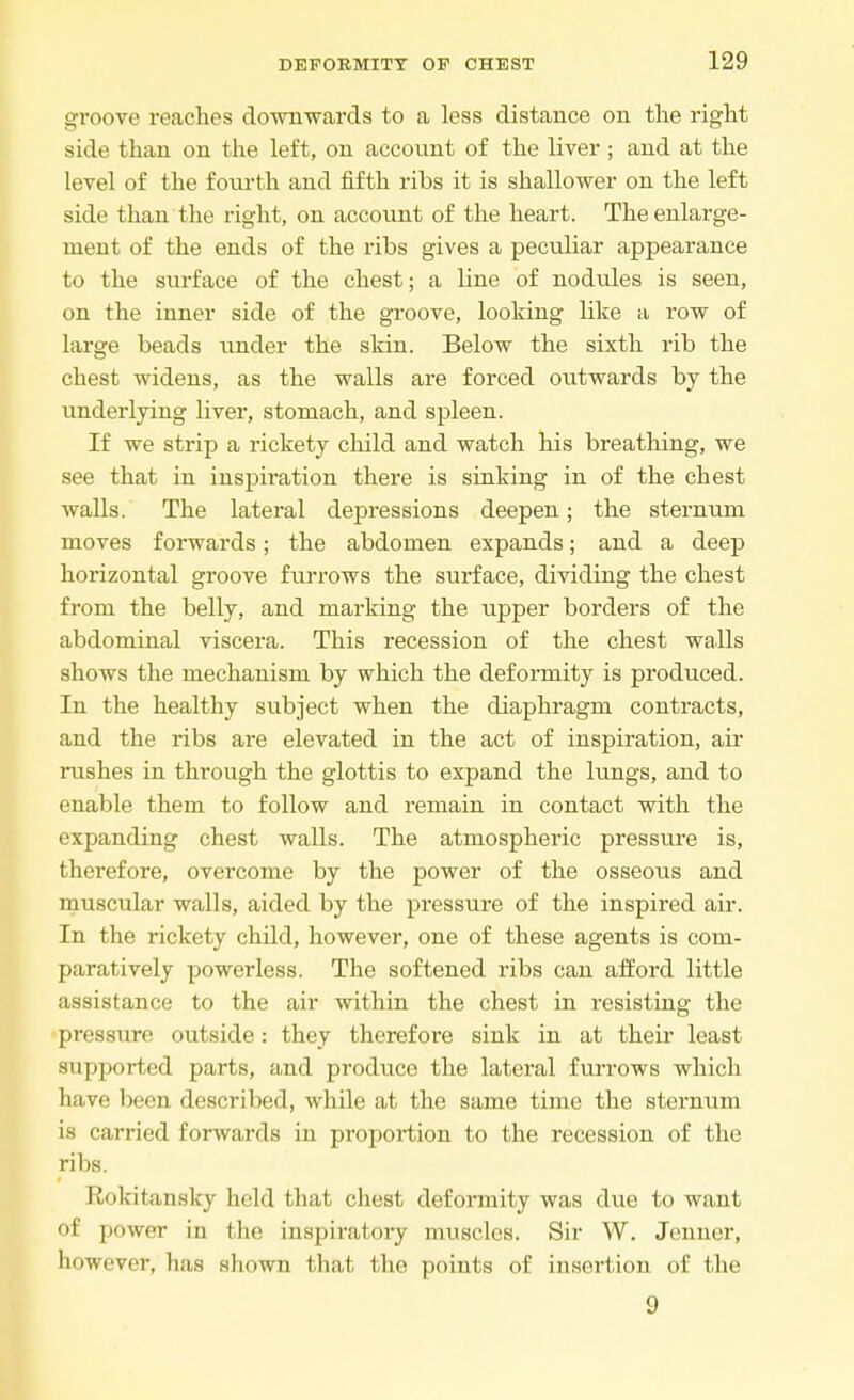 groove reaches downwards to a less distance on the right side than on the left, on account of the liver ; and at the level of the fourth and fifth ribs it is shallower on the left side than the right, on account of the heart. The enlarge- ment of the ends of the ribs gives a peculiar appearance to the surface of the chest; a line of nodules is seen, on the inner side of the groove, looking like a row of large beads under the skin. Below the sixth rib the chest widens, as the walls are forced outwards by the underlying liver, stomach, and spleen. If we strip a rickety child and watch his breathing, we see that in inspiration there is sinking in of the chest walls. The lateral depressions deepen; the sternum moves forwards; the abdomen expands; and a deep horizontal groove furrows the surface, dividing the chest from the belly, and marking the upper borders of the abdominal viscera. This recession of the chest walls shows the mechanism by which the deformity is produced. In the healthy subject when the diaphragm contracts, and the ribs are elevated in the act of inspiration, air rushes in through the glottis to expand the lungs, and to enable them to follow and remain in contact with the expanding chest walls. The atmospheric pressure is, therefore, overcome by the power of the osseous and muscular walls, aided by the pressure of the inspired air. In the rickety child, however, one of these agents is com- paratively powerless. The softened ribs can afford little assistance to the air within the chest in resisting the pressure outside: they therefore sink in at their least supported parts, and produce the lateral furrows which have been described, while at the same time the sternum is carried forwards in proportion to the recession of the ribs. Rokitansky held that chest deformity was due to want <>l power in the inspiratory muscles. Sir W. Jcnner, however, has shown that the points of insertion of the 9