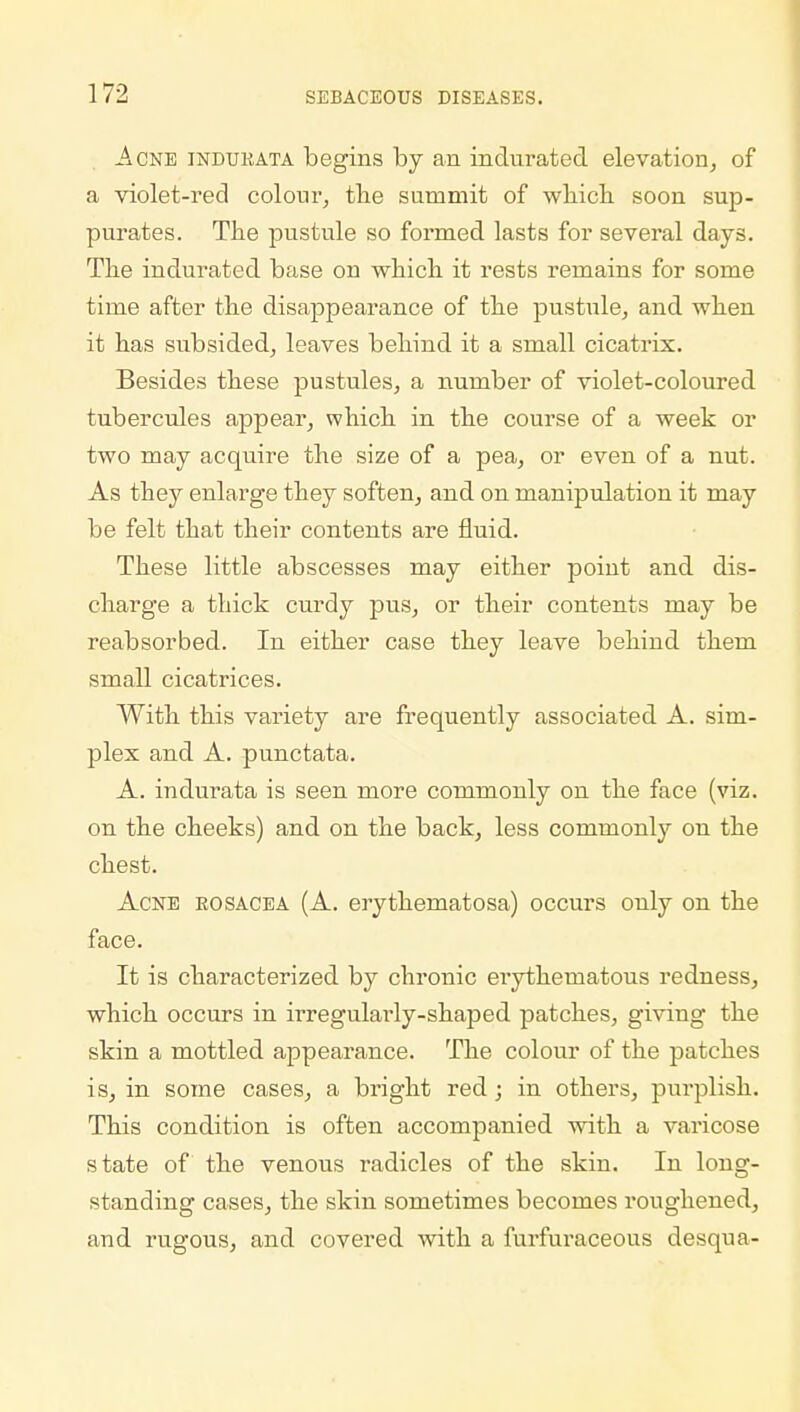 Acne indurata begins by an indurated elevation, of a violet-red colour, the summit of which soon sup- purates. The pustule so formed lasts for several days. The indurated base on which it rests remains for some time after the disappearance of the pustule, and when it has subsided, leaves behind it a small cicatrix. Besides these pustules, a number of violet-coloured tubercules appear, which in the course of a week or two may acquire the size of a pea, or even of a nut. As they enlarge they soften, and on manipulation it may be felt that their contents are fluid. These little abscesses may either poiut and dis- charge a thick curdy pus, or their contents may be reabsorbed. In either case they leave behind them small cicatrices. With this variety are frequently associated A. sim- plex and A. punctata. A. indurata is seen more commonly on the face (viz. on the cheeks) and on the back, less commonly on the chest. Acne rosacea (A. erythematosa) occurs only on the face. It is characterized by chronic erythematous redness, which occurs in irregulai'ly-shaped patches, giving the skin a mottled appearance. The colour of the patches is, in some cases, a bright red; in others, purplish. This condition is often accompanied with a varicose state of the venous radicles of the skin. In long- standing cases, the skin sometimes becomes roughened, and rugous, and covered with a furfuraceous desqua-