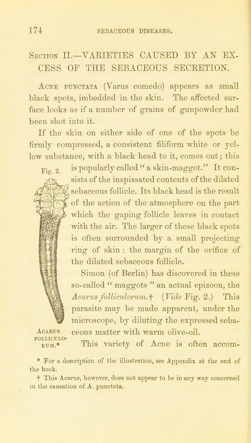 Section II.—VARIETIES CAUSED BY AN EX- CESS OF THE SEBACEOUS SECRETION. Acne punctata (Varus comedo) appears as small black spots, imbedded in the skin. The affected sur- face looks as if a number of grains of gunpowder had been shot into it. If the skin on either side of one of the spots be firmly compressed, a consistent filiform white or yel- low substance, with a black head to it, comes out; this Fig 2 ^s popularly called  a skin-maggot. It con- sists of the inspissated contents of the dilated , sebaceous follicle. Its black head is the result of the action of the atmosphere on the part which the gaping follicle leaves in contact with the air. The larger of these black spots is often surrounded by a small projecting ring of skin : the margin of the orifice of the dilated sebaceous follicle. Simon (of Berlin) has discovered in these so-called  maggots  an actual epizoon, the Acarus folliculorum.f (Vide Fig. -2.) This parasite may be made apparent, under the microscope, by diluting the expressed seba- Acartts ceous matter with warm olive-oil. FOLLICUIO- . . hum.* This variety of Acne is often accom- * For a description of the illustration, see Appendix at the end of the book. + This Acarus, however, does not appear to be in any way concerned in the causation of A. punctata.