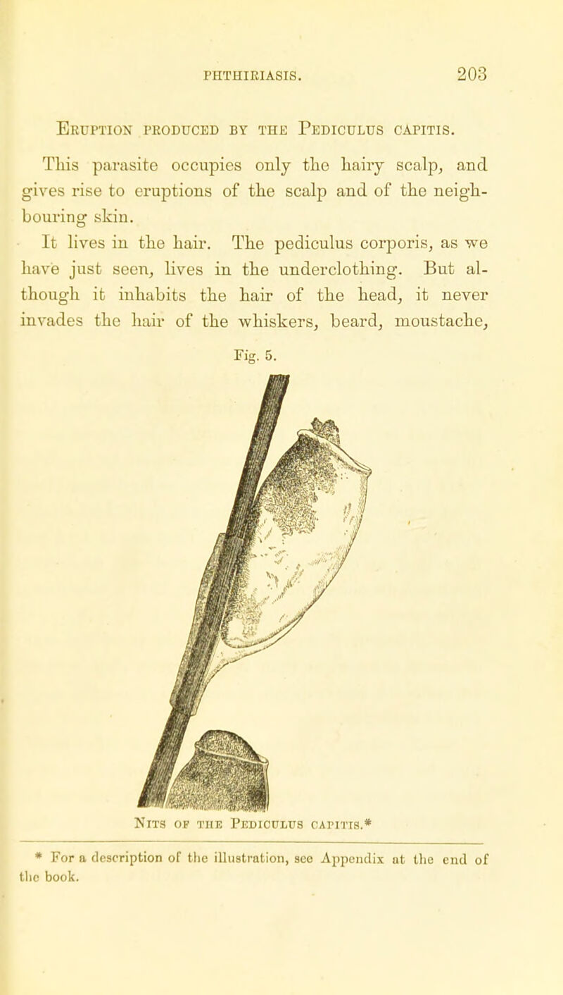 Eruption produced by the Pediculus capitis. This parasite occupies only the liaiiy scalp, and gives rise to eruptions of the scalp and of the neigh- bouring skin. It lives in the hair. The pediculus corporis, as -we have just seen, lives in the underclothing. But al- though it inhabits the hair of the head, it never invades the hair of the whiskers, beard, moustache, Fig. 5. Nits op the Pedicpltjs capitis.* * For a description of the illustration, seo Appendix at the end of the book.