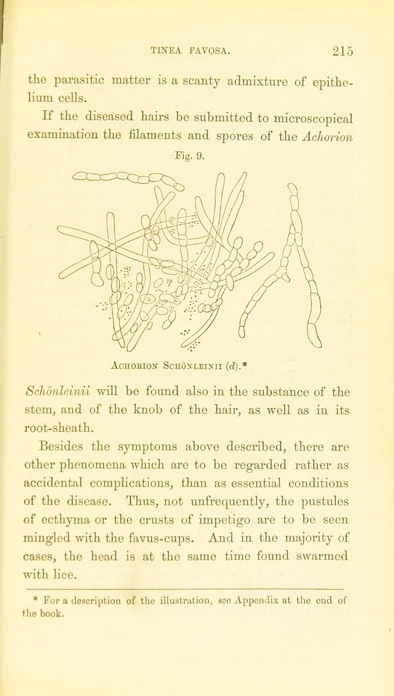 the parasitic matter is a scanty admixture of epithe- lium cells. If the diseased hairs be submitted to microscopical examination the filaments and spores of the Achorion Fig. 9. Achoeion Schonleinii (d).* Schdnleinii will be found also in the substance of the stem, and of the knob of the hair, as well as in its root-sheath. Besides the symptoms above described, there are other phenomena which are to be regarded rather as accidental complications, than as essential conditions of the disease. Thus, not unfrequently, the pustules of ecthyma or the crusts of impetigo are to be seen mingled with the favus-cups. And in the majority of cases, the head is at the same time found swarmed with lice. * For a description of the illustration, soo Appendix at tho end of