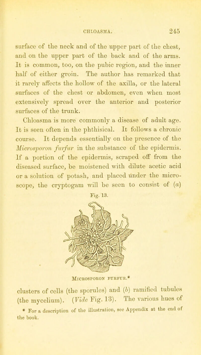 surface of the neck and of the upper part of the chest, and on the upper part of the back and of the arms. It is common, too, on the pubic region, and the inner half of either groin. The author has remarked that it rarely affects the hollow of the axilla, or the lateral surfaces of the chest or abdomen, even when most extensively spread over the anterior and posterior surfaces of the trunk. Chloasma is more commonly a disease of adult age. It is seen often in the phthisical. It follows a chronic course. It depends essentially on the presence of the Microsporon furfur in the substance of the epidermis. If a portion of the epidermis, scraped off from the diseased surface, be moistened with dilute acetic acid or a solution of potash, and placed Under the micro- scope, the cryptogam will be seen to consist of (a) Fig. 13. Microsporon furfur.* clusters of cells (the sporules) and {b) ramified tubules (the mycelium). {Vide Fig. 18). The various hues of * For a description of the illustration, see Appendix at tho end of the book.