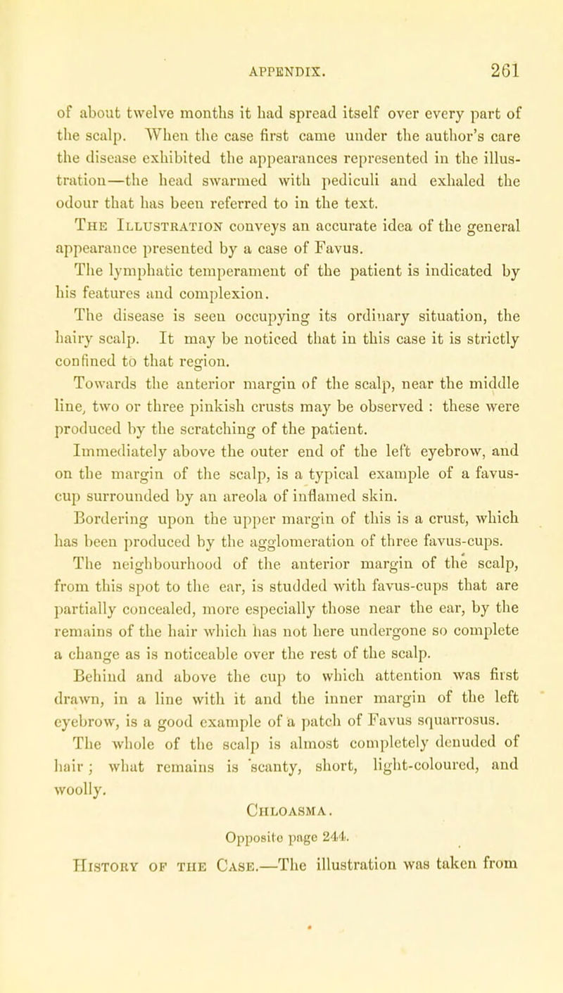 of about twelve months it had spread itself over every part of the scalp. When the case first came under the author's care the disease exhibited the appearances represented in the illus- tration—the head swarmed with pediculi and exhaled the odour that has been referred to in the text. The Illustration conveys an accurate idea of the general appearance presented by a case of Favus. The lymphatic temperament of the patient is indicated by his features and complexion. The disease is seen occupying its ordinary situation, the hairy scalp. It may be noticed that in this case it is strictly confined to that region. Towards the anterior margin of the scalp, near the middle line, two or three pinkish crusts may be observed : these were produced by the scratching of the patient. Immediately above the outer end of the left eyebrow, and on the margin of the scalp, is a typical example of a favus- cup surrounded by an areola of inflamed skin. Bordering upon the upper margin of this is a crust, which has been produced by the agglomeration of three favus-cups. The neighbourhood of the anterior margin of the scalp, from this spot to the ear, is studded with favus-cups that are partially concealed, more especially those near the ear, by the remains of the hair which has not here undergone so complete a change as is noticeable over the rest of the scalp. Behind and above the cup to which attention was first drawn, in a line with it and the inner margin of the left eyebrow, is a good example of a patch of Favus squarrosus. The whole of the scalp is almost completely denuded of hair; what remains is 'scanty, short, light-coloured, and woolly. Chloasma. Opposite pngc 244. History of the Case.—The illustration was taken from