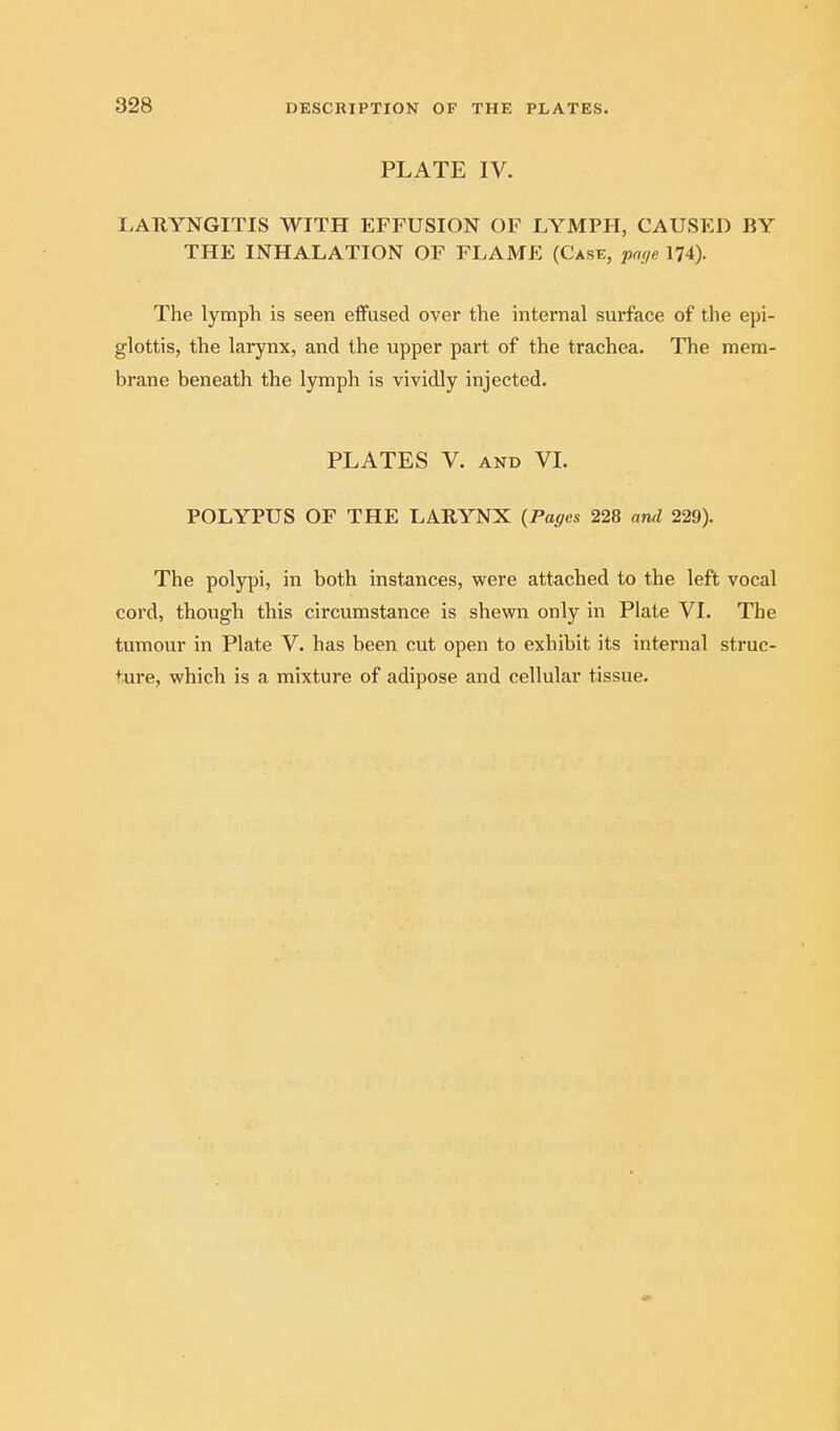 PLATE IV. LARYNGITIS WITH EFFUSION OF LYMPH, CAUSED BY THE INHALATION OF FLAME (Case, page 174). The lymph is seen eflfused over the internal surface of the epi- glottis, the larynx, and the upper part of the trachea. The mem- brane beneath the lymph is vividly injected. PLATES V. AND VL POLYPUS OF THE LARYNX {Pages 228 and 229). The polypi, in both instances, were attached to the left vocal cord, though this circumstance is shewn only in Plate VL The tumour in Plate V. has been cut open to exhibit its internal struc- ture, which is a mixture of adipose and cellular tissue.