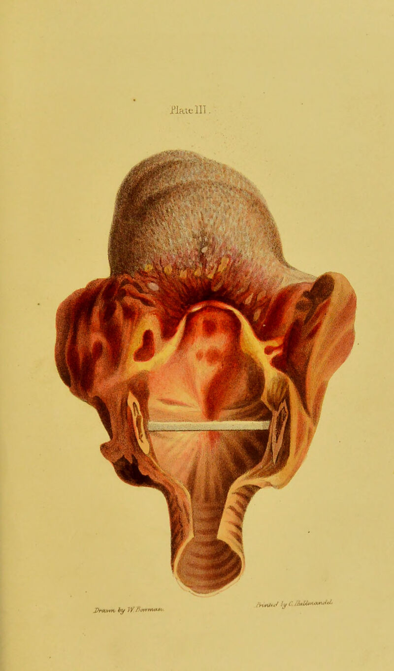 PlfLlflll J>ranm htf }y flmrmMv