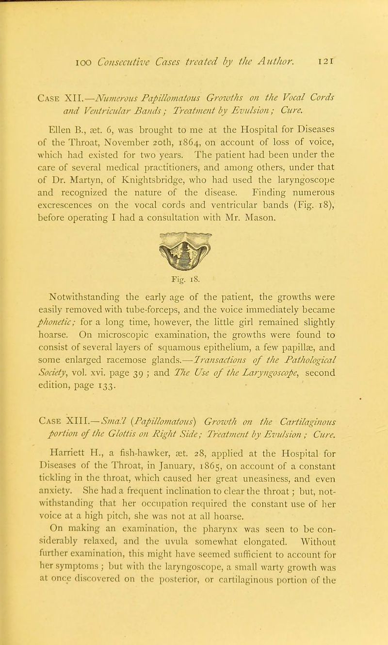 Case XII.—Numerous Papillomatous Growths on the Vocal Cords and Ventricular Bands ; Treatment by Evulsion; Cure. Ellen B., cet. 6, was brought to me at the Hospital for Diseases of the Throat, November 20th, 1864, on account of loss of voice, which had existed for two years. The patient had been under the care of several medical practitioners, and among others, under that of Dr. Martyn, of Knightsbridge, who had used the laryngoscope and recognized the nature of the disease. Finding numerous excrescences on the vocal cords and ventricular bands (Fig. 18), before operating I had a consultation with Mr. Mason. Fig. 18. Notwithstanding the early age of the patient, the growths were easily removed with tube-forceps, and the voice immediately became phonetic; for a long time, however, the little girl remained slightly hoarse. On microscopic examination, the growths were found to consist of several layers of squamous epithelium, a few papillae, and some enlarged racemose glands.—Transactions of the Pathological Society, vol. xvi. page 39 ; and Tlie Use of the Laryngoscope, second edition, page 133. Case XIII.—Small {Papillomatous) Growth on the Cartilaginous portion of the Glottis on Right Side; Treatment by Evulsion ; Cure. Harriett H., a fish-hawker, set. 28, applied at the Hospital for D iseases of the Throat, in January, 1865, on account of a constant tickling in the throat, which caused her great uneasiness, and even anxiety. She had a frequent inclination to clear the throat; but, not- withstanding that her occupation required the constant use of her voice at a high pitch, she was not at all hoarse. On making an examination, the pharynx was seen to be con- siderably relaxed, and the uvula somewhat elongated. Without further examination, this might have seemed sufficient to account for her symptoms ; but w ith the laryngoscope, a small warty growth was al price discovered on the posterior, or cartilaginous portion of the