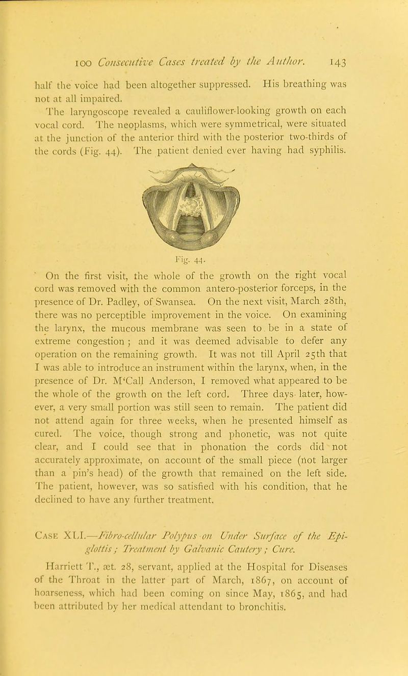 half the voice had been altogether suppressed. His breathing was not at all impaired. The laryngoscope revealed a cauliflower-looking growth on each vocal cord. The neoplasms, which were symmetrical, were situated at the junction of the anterior third with the posterior two-thirds of the cords (Fig. 44). The patient denied ever having had syphilis. Fig- 4-1 • On the first visit, the whole of the growth on the right vocal cord was removed with the common antero-posterior forceps, in the presence of Dr. Padley, of Swansea. On the next visit, March 28th, there was no perceptible improvement in the voice. On examining the larynx, the mucous membrane was seen to be in a state of extreme congestion ; and it was deemed advisable to defer any operation on the remaining growth. It was not till April 25th that I was able to introduce an instrument within the larynx, when, in the presence of Dr. M'Call Anderson, I removed what appeared to be the whole of the growth on the left cord. Three days- later, how- ever, a very small portion was still seen to remain. The patient did not attend again for three weeks, when he presented himself as cured. The voice, though strong and phonetic, was not quite clear, and I could see that in phonation the cords did not accurately approximate, on account of the small piece (not larger than a pin's head) of the growth that remained on the left side. The patient, however, was so satisfied with his condition, that he declined to have any further treatment. Case XLI.—Fibro-ccllular Polypus on Under Surface of the Epi- glottis ; Treatment by Galvanic Cautery; Cure. Harriett T., aet. 28, servant, applied at the Hospital for Diseases of the Throat in the latter part of March, 1867, on account of hoarseness, which had been coming on since May, 1865, and had been attributed by her medical attendant to bronchitis.
