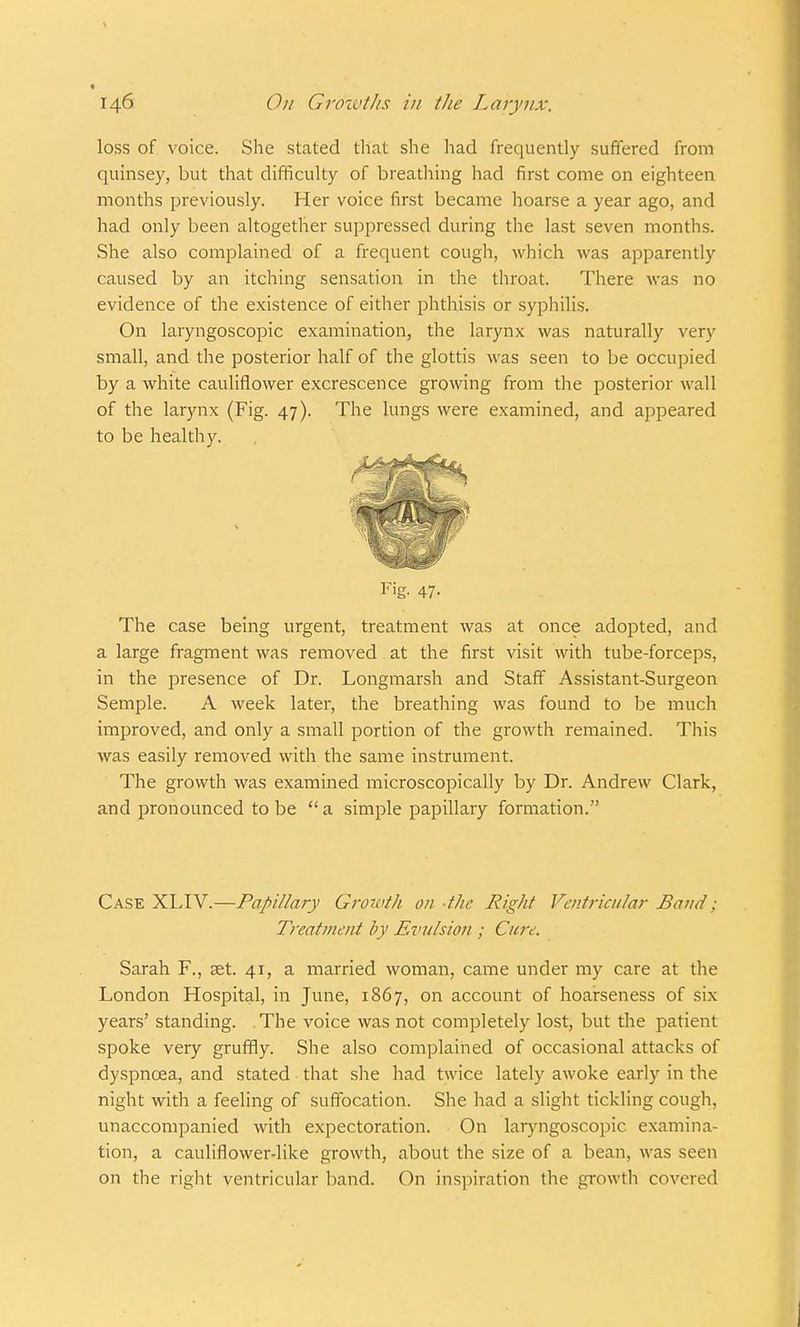 loss of voice. She stated that she had frequently suffered from quinsey, but that difficulty of breathing had first come on eighteen months previously. Her voice first became hoarse a year ago, and had only been altogether suppressed during the last seven months. She also complained of a frequent cough, which was apparently caused by an itching sensation in the throat. There was no evidence of the existence of either phthisis or syphilis. On laryngoscopic examination, the larynx was naturally very small, and the posterior half of the glottis was seen to be occupied by a white cauliflower excrescence growing from the posterior w all of the larynx (Fig. 47). The lungs were examined, and appeared to be healthy. F>g- 47- The case being urgent, treatment was at once adopted, and a large fragment was removed at the first visit with tube-forceps, in the presence of Dr. Longmarsh and Staff Assistant-Surgeon Semple. A week later, the breathing was found to be much improved, and only a small portion of the growth remained. This was easily removed with the same instrument. The growth was examined microscopically by Dr. Andrew Clark, and pronounced to be a simple papillary formation. Case XLIV.—Papillary Growth on the Right Ventricular Band; Treatment by Evulsion ; Cure. Sarah F., set. 41, a married woman, came under my care at the London Hospital, in June, 1867, on account of hoarseness of six years' standing. The voice was not completely lost, but the patient spoke very gruffly. She also complained of occasional attacks of dyspncea, and stated that she had twice lately awoke early in the night with a feeling of suffocation. She had a slight tickling cough, unaccompanied with expectoration. On laryngoscopic. examina- tion, a cauliflower-like growth, about the size of a bean, was seen on the right ventricular band. On inspiration the growth covered