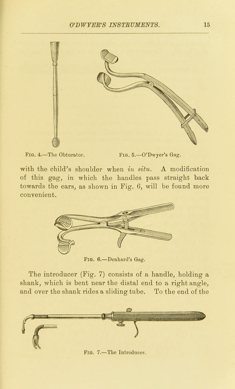 Fig. 4.—The Obturator. FiG. 5.—O'Dwyer's Gag. with the child's shoulder when in situ. A modification of this gag, in which the handles pass straight back towards the earsj as shown in Fig. 6, will be found more convenient. Pig. 6.—Denhard's Gag. The introducer (Fig. 7) consists of a handle, holding a shank, which is bent near the distal end to a right angle, and over the shank rides a sliding tube. To the end of the Fig. 7.—The Introducer.