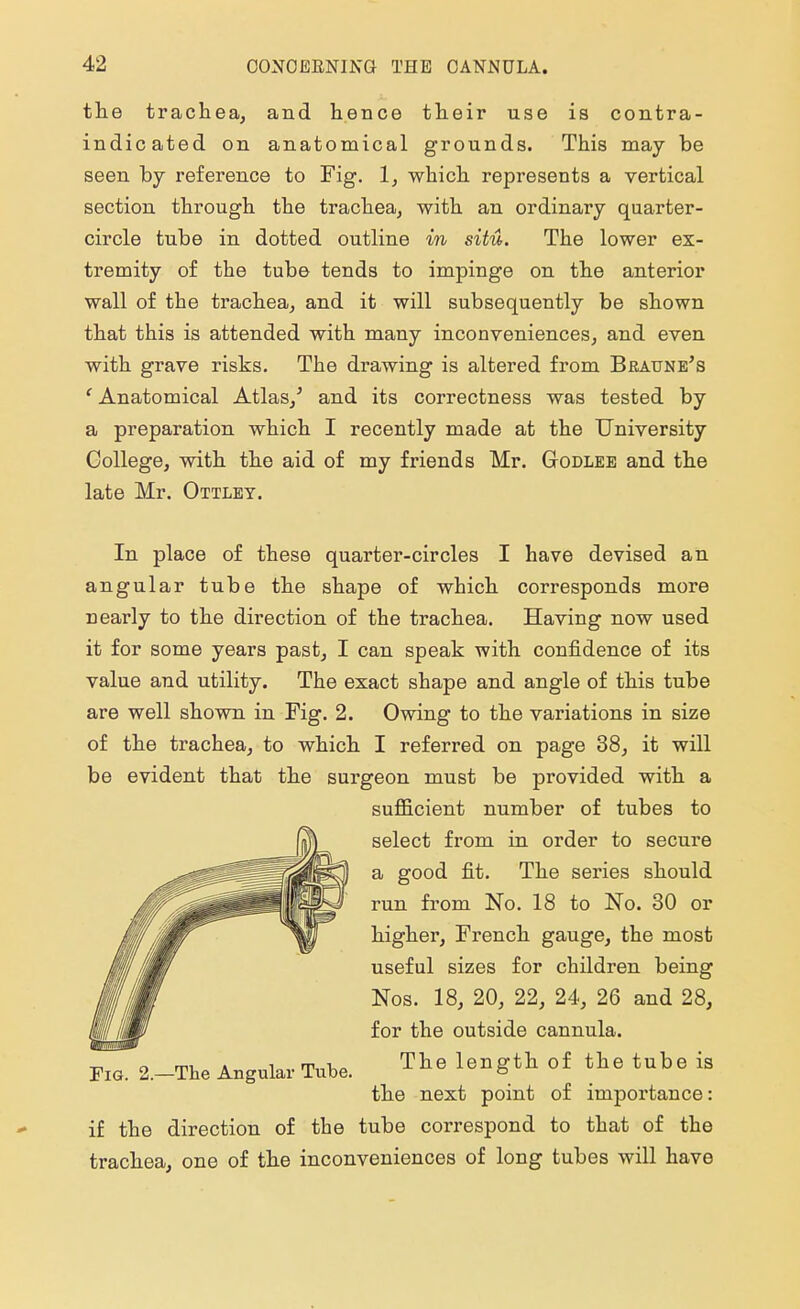 the trachea, and hence their use is contra- indicated on anatomical grounds. This may be seen by reference to Fig. 1, which represents a vertical section through the trachea, with an ordinary quarter- circle tube in dotted outline in situ. The lower ex- tremity of the tube tends to impinge on the anterior wall of the trachea, and it will subsequently be shown that this is attended with many inconveniences, and even with grave risks. The drawing is altered from Braune's ' Anatomical Atlas/ and its correctness was tested by a preparation which I recently made at the University College, with the aid of my friends Mr. Godlee and the late Mr. Ottley. In place of these quarter-circles I have devised an angular tube the shape of which corresponds more nearly to the direction of the trachea. Having now used it for some years past, I can speak with confidence of its value and utility. The exact shape and angle of this tube are well shown in Fig. 2. Owing to the variations in size of the trachea, to which I referred on page 38, it will be evident that the surgeon must be provided with a sufficient number of tubes to select from in order to secure a good fit. The series should run from No. 18 to No. 30 or higher, French gauge, the most useful sizes for children being Nos. 18, 20, 22, 24, 26 and 28, for the outside cannula. Fig. 2.-The Angular Tube. The of the tube is the next point of importance: if the direction of the tube correspond to that of the trachea, one of the inconveniences of long tubes will have