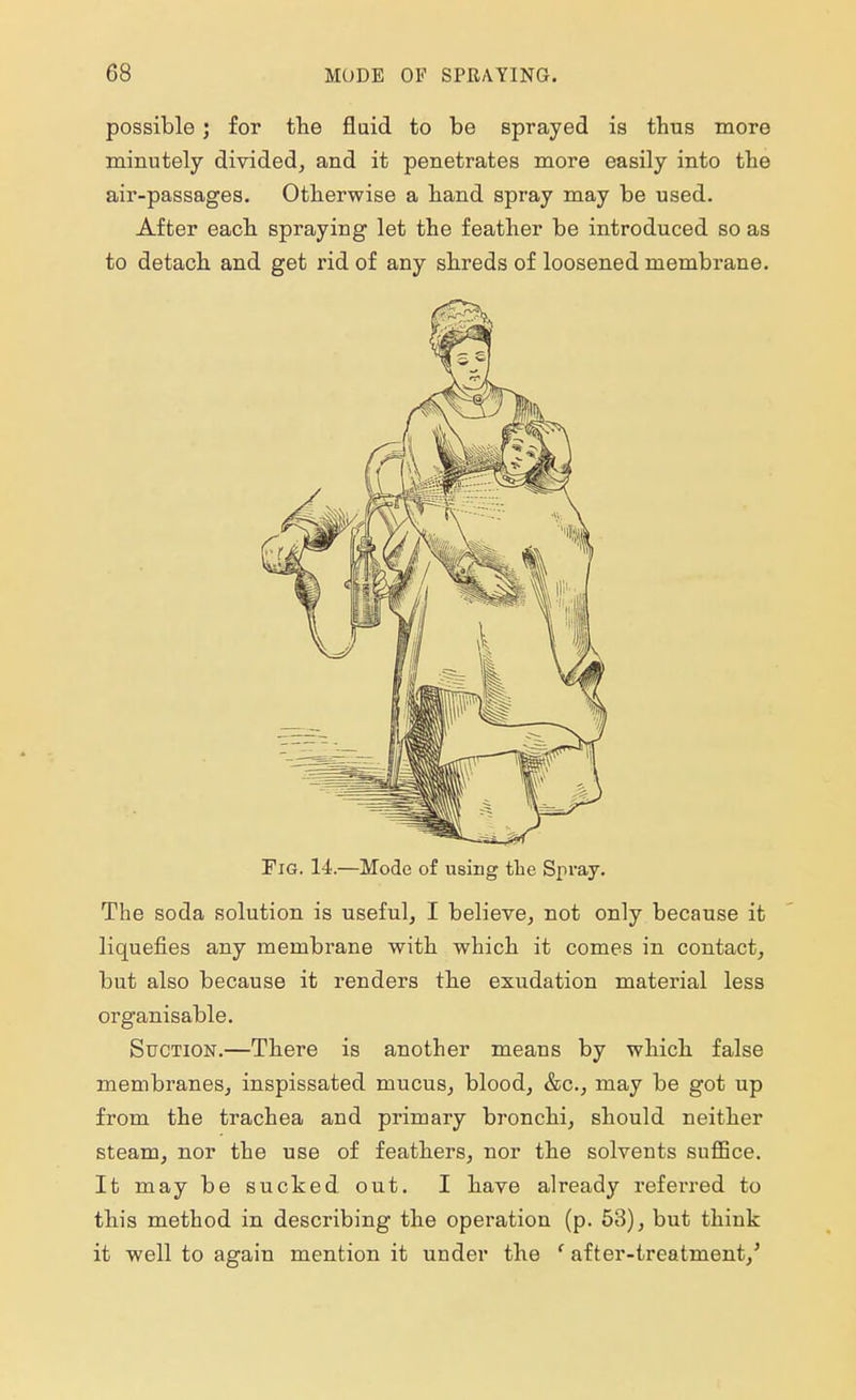 possible ; for the fluid to be sprayed is thus more minutely divided, and it penetrates more easily into the air-passages. Otherwise a hand spray may be used. After each spraying let the feather be introduced so as to detach and get rid of any shreds of loosened membrane. Fig. 14.—Mode of using the Spray. The soda solution is useful, I believe, not only because it liquefies any membrane with which it comes in contact, but also because it renders the exudation material less organisable. Suction.—There is another means by which false membranes, inspissated mucus, blood, &c, may be got up from the trachea and primary bronchi, should neither steam, nor the use of feathers, nor the solvents suffice. It may be sucked out. I have already referred to this method in describing the operation (p. 53), but think it well to again mention it under the f after-treatment/
