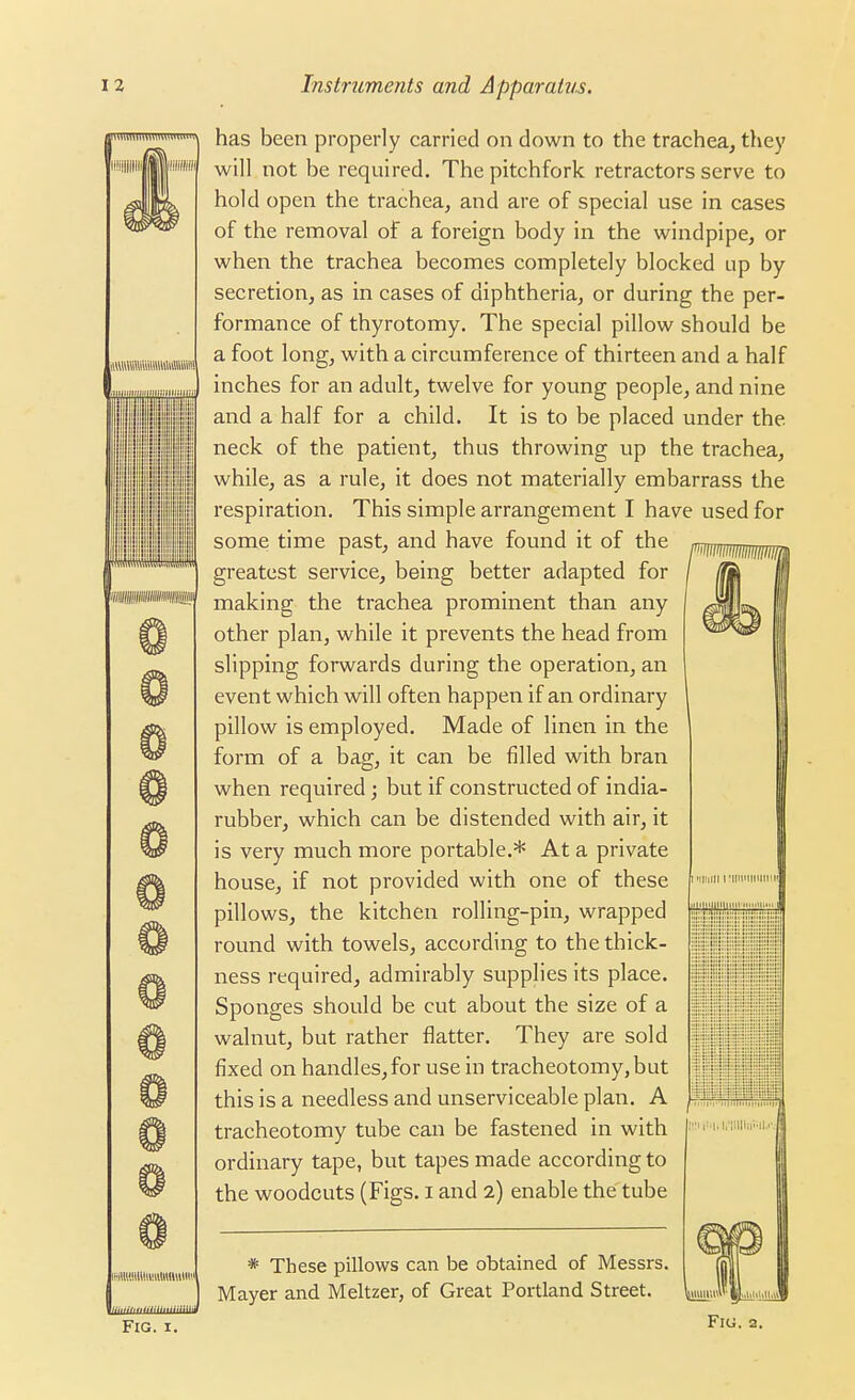 am Mi IMlKWllllilUWMlmi Fig. I. has been properly carried on down to the trachea, they will not be required. The pitchfork retractors serve to hold open the trachea, and are of special use in cases of the removal of a foreign body in the windpipe, or when the trachea becomes completely blocked up by secretion, as in cases of diphtheria, or during the per- formance of thyrotomy. The special pillow should be a foot long, with a circumference of thirteen and a half iches for an adult, twelve for young people, and nine nd a half for a child. It is to be placed under the eck of the patient, thus throwing up the trachea, hile, as a rule, it does not materially embarrass the lespiration. This simple arrangement I have used for some time past, and have found it of the greatest service, being better adapted for making the trachea prominent than any other plan, while it prevents the head from slipping forwards during the operation, an event which will often happen if an ordinary pillow is employed. Made of linen in the form of a bag, it can be filled with bran when required; but if constructed of india- rubber, which can be distended with air, it is very much more portable.* At a private house, if not provided with one of these pillows, the kitchen rolling-pin, wrapped round with towels, according to the thick- ness required, admirably supplies its place. Sponges should be cut about the size of a walnut, but rather flatter. They are sold fixed on handles, for use in tracheotomy, but this is a needless and unserviceable plan. A tracheotomy tube can be fastened in with ordinary tape, but tapes made according to the woodcuts (Figs, i and 2) enable the tube * These pillows can be obtained of Messrs. Mayer and Meltzer, of Great Portland Street. Fig. a.