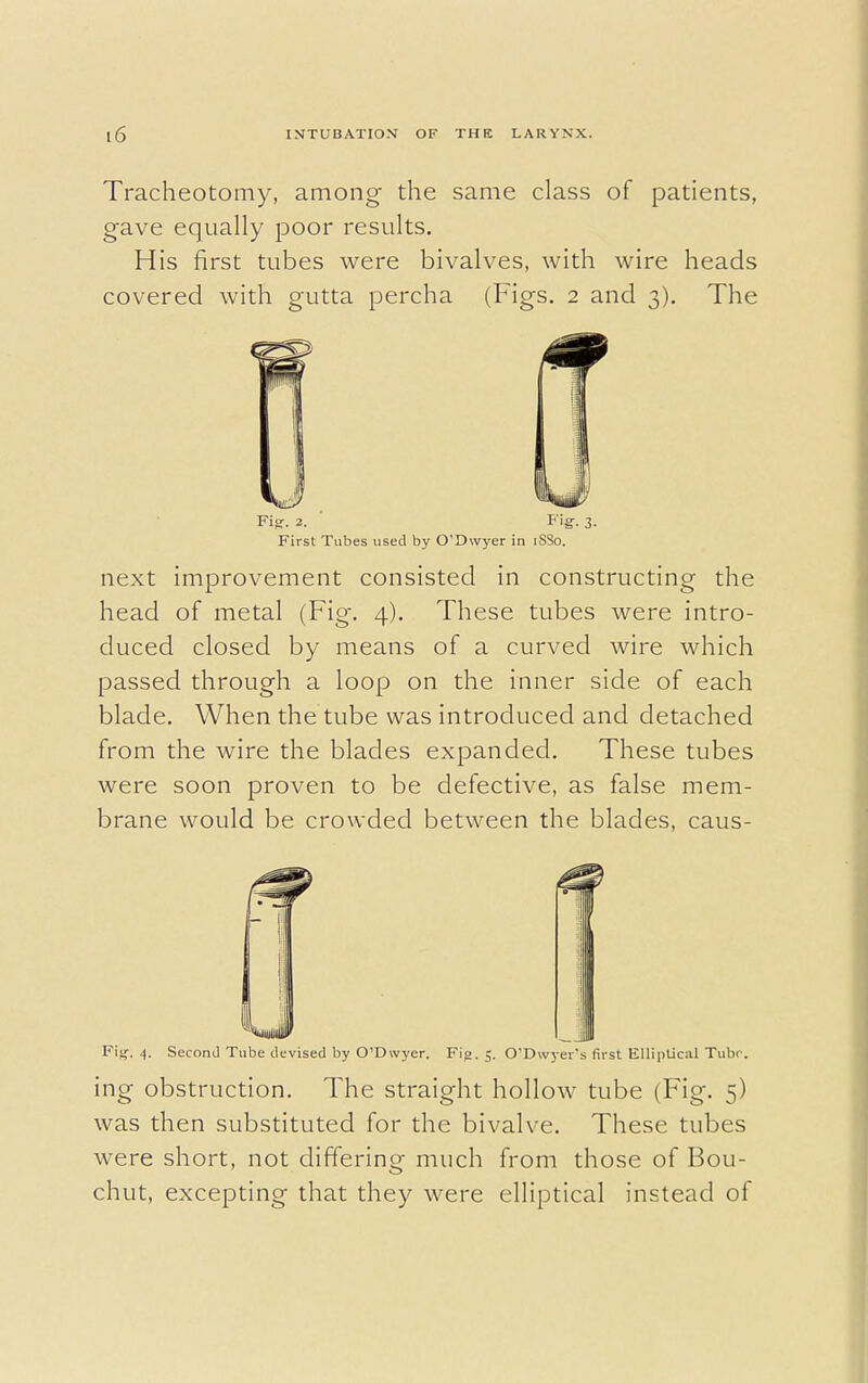 Tracheotomy, among the same class of patients, gave equally poor results. His first tubes were bivalves, with wire heads covered with gutta percha (Figs. 2 and 3). The Fig-. 2. ' B ig-. 3. First Tubes used by O'Dwyer in 1SS0. next improvement consisted in constructing the head of metal (Fig. 4). These tubes were intro- duced closed by means of a curved wire which passed through a loop on the inner side of each blade. When the tube was introduced and detached from the wire the blades expanded. These tubes were soon proven to be defective, as false mem- brane would be crowded between the blades, caus- Fig. 4. Second Tube devised by O'Dwyer. Fig. 5. O'Dwyer's first Elliptical Tube. ing obstruction. The straight hollow tube (Fig. 5) was then substituted for the bivalve. These tubes were short, not differing much from those of Bou- chut, excepting that they were elliptical instead of