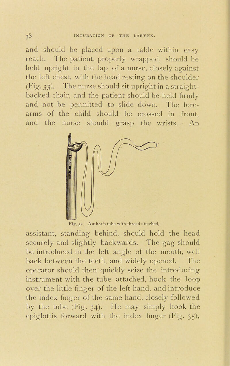 and should be placed upon a table within easy- reach. The patient, properly wrapped, should be held upright in the lap of a nurse, closely against the left chest, with the head resting on the shoulder (Fig. 33). The nurse should sit upright in a straight- backed chair, and the patient should be held firmly and not be permitted to slide down. The fore- arms of the child should be crossed in front, and the nurse should grasp the wrists. An Ftp. 32. Author's tube with thread attached. assistant, standing behind, should hold the head securely and slightly backwards. The gag should be introduced in the left angle of the mouth, well back between the teeth, and widely opened. The operator should then quickly seize the introducing instrument with the tube attached, hook the loop over the little finger of the left hand, and introduce the index finger of the same hand, closely followed by the tube (Fig. 34). He may simply hook the epiglottis forward with the index finger (Fig-. 35),