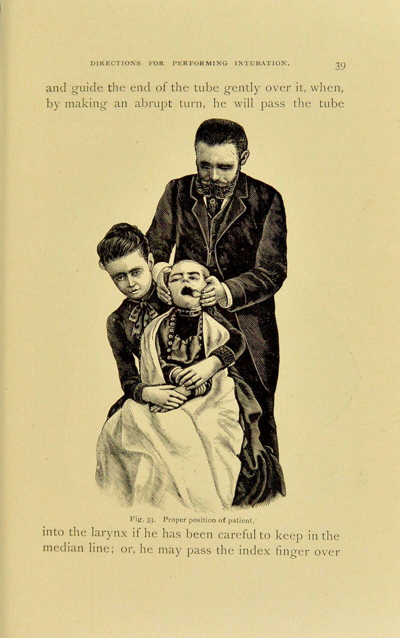 and guide the end of the tube gently over it, when, by making an abrupt turn, he will pass the tube F'ff- 3.3- Proper position of patient/ into the larynx if he has been careful to keep in the median line; or, he may pass the index linger over